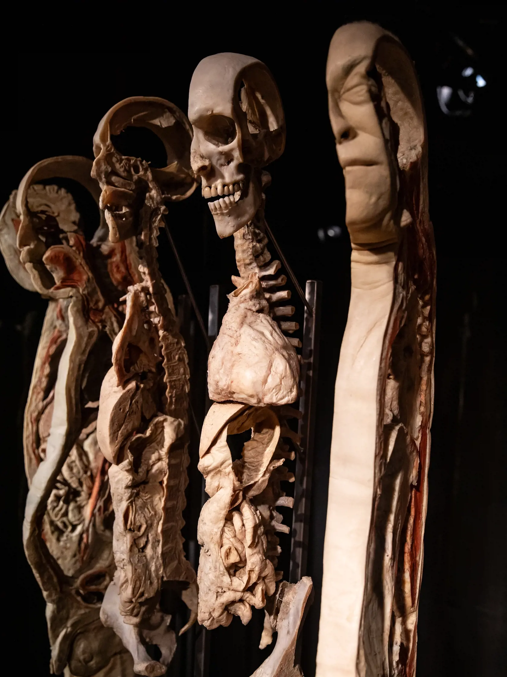 V piatok 13.10. začala v bratislavskom  nákupnom centre Nivy podľa viacerých odborníkov a mimovládnych organizácii kontroverzná výstava Body Worlds.