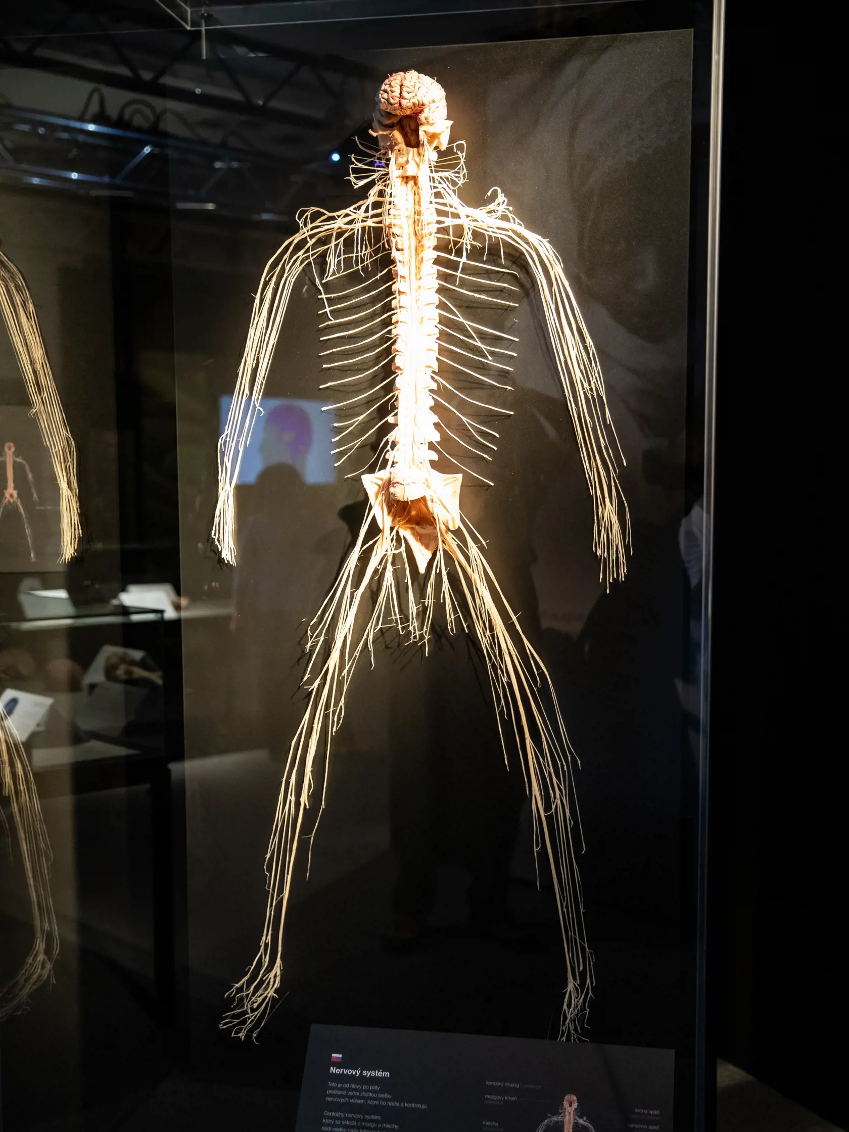 V piatok 13.10. začala v bratislavskom  nákupnom centre Nivy podľa viacerých odborníkov a mimovládnych organizácii kontroverzná výstava Body Worlds.