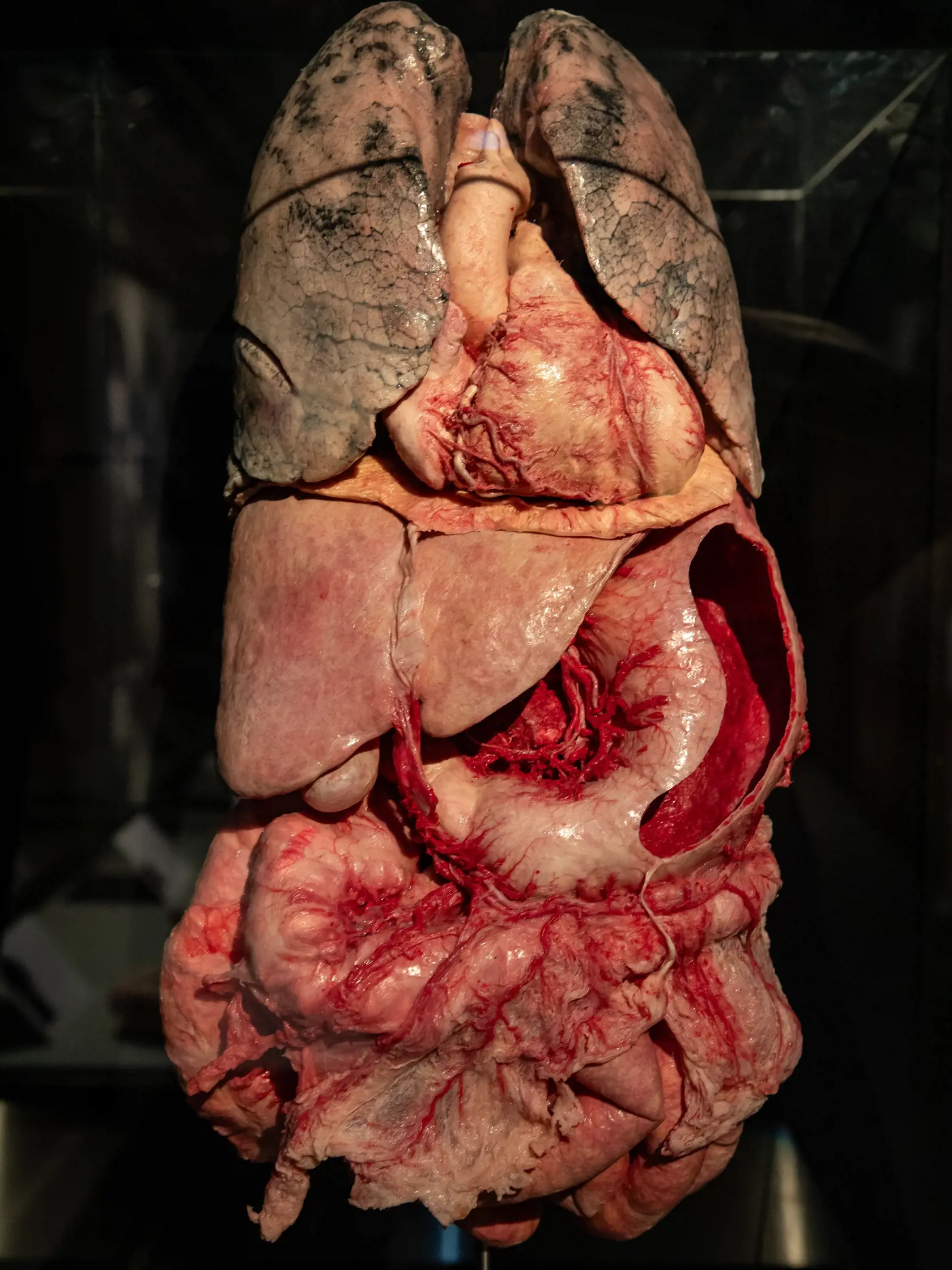 V piatok 13.10. začala v bratislavskom  nákupnom centre Nivy podľa viacerých odborníkov a mimovládnych organizácii kontroverzná výstava Body Worlds.