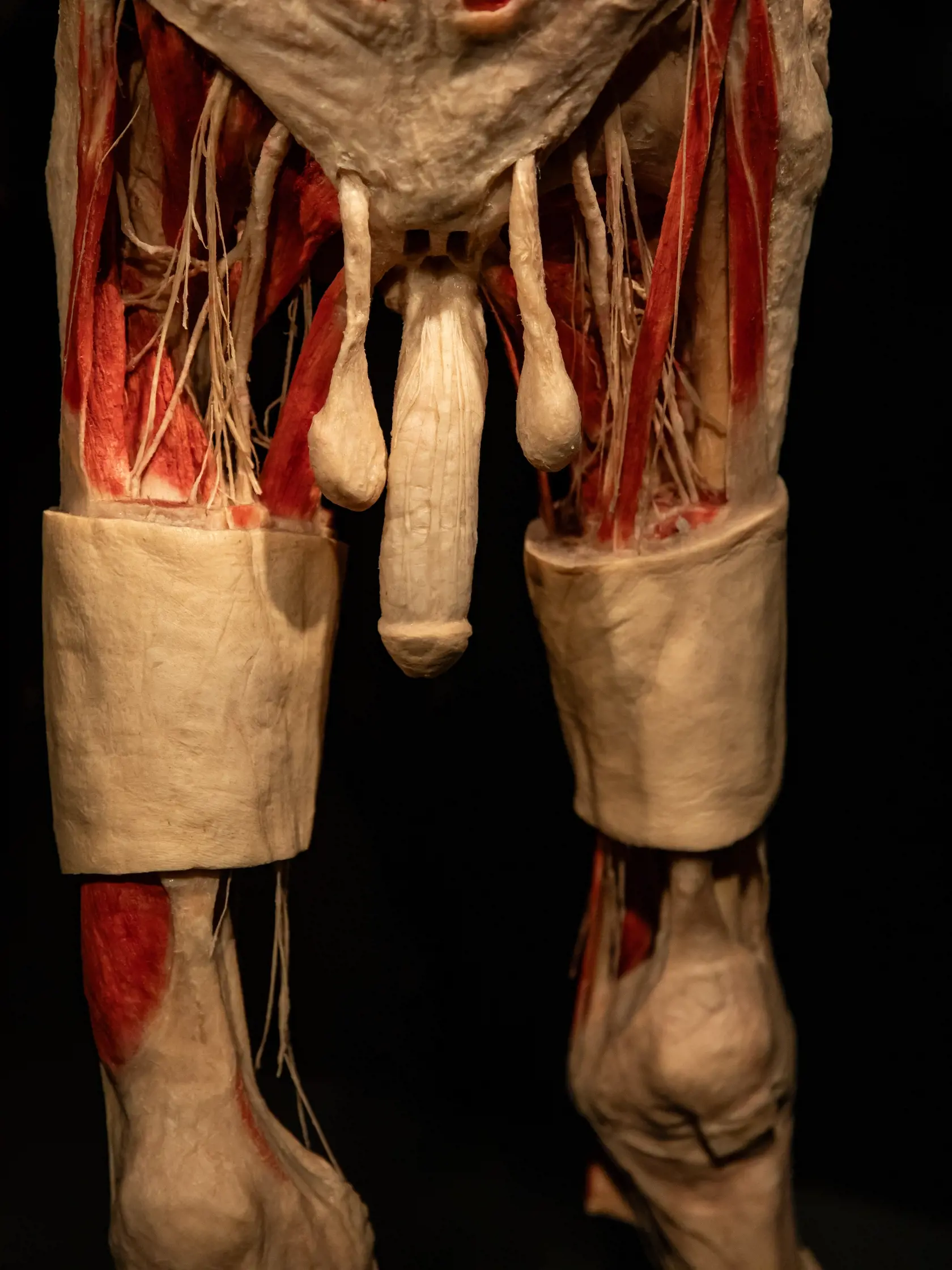 V piatok 13.10. začala v bratislavskom  nákupnom centre Nivy podľa viacerých odborníkov a mimovládnych organizácii kontroverzná výstava Body Worlds.