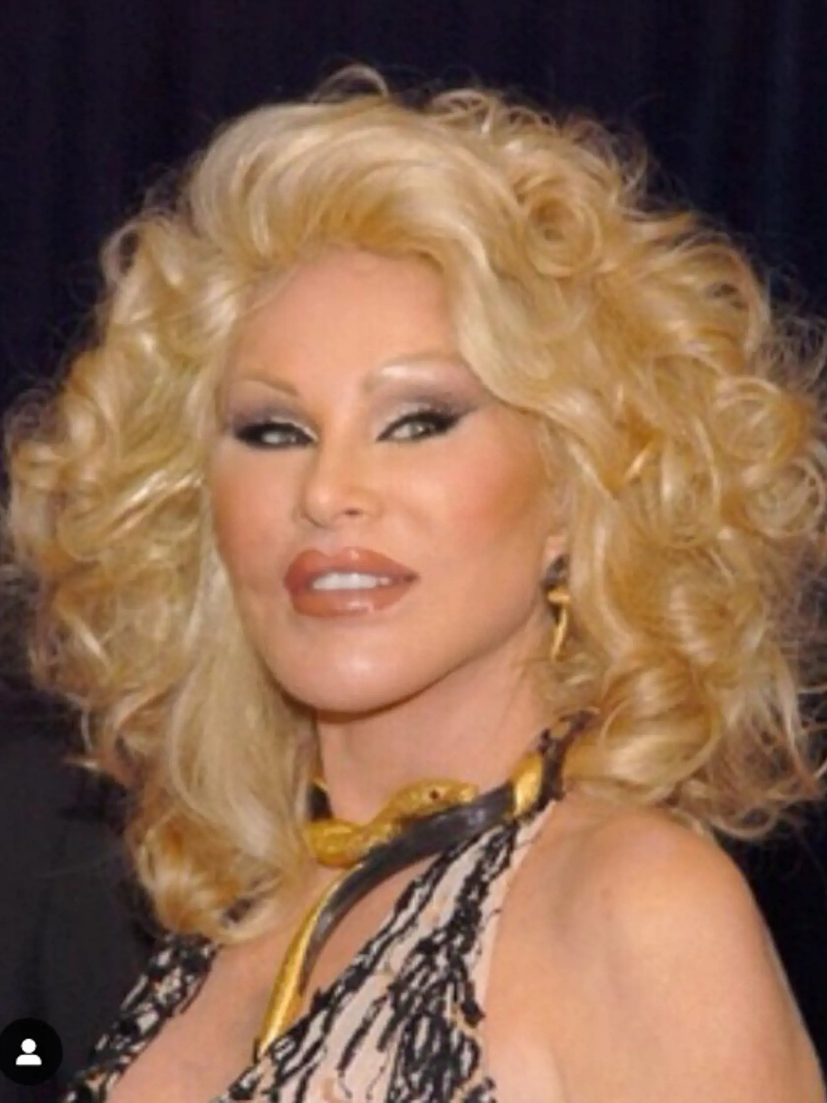 Jocelyn Wildenstein je pre svoje plastické operácie vo svete známa ako mačacia žena. Mnohých však jej výzor dnes skôr desí. Teraz fanúšikov prekvapili zverejnením fotografií z čias dospievania.