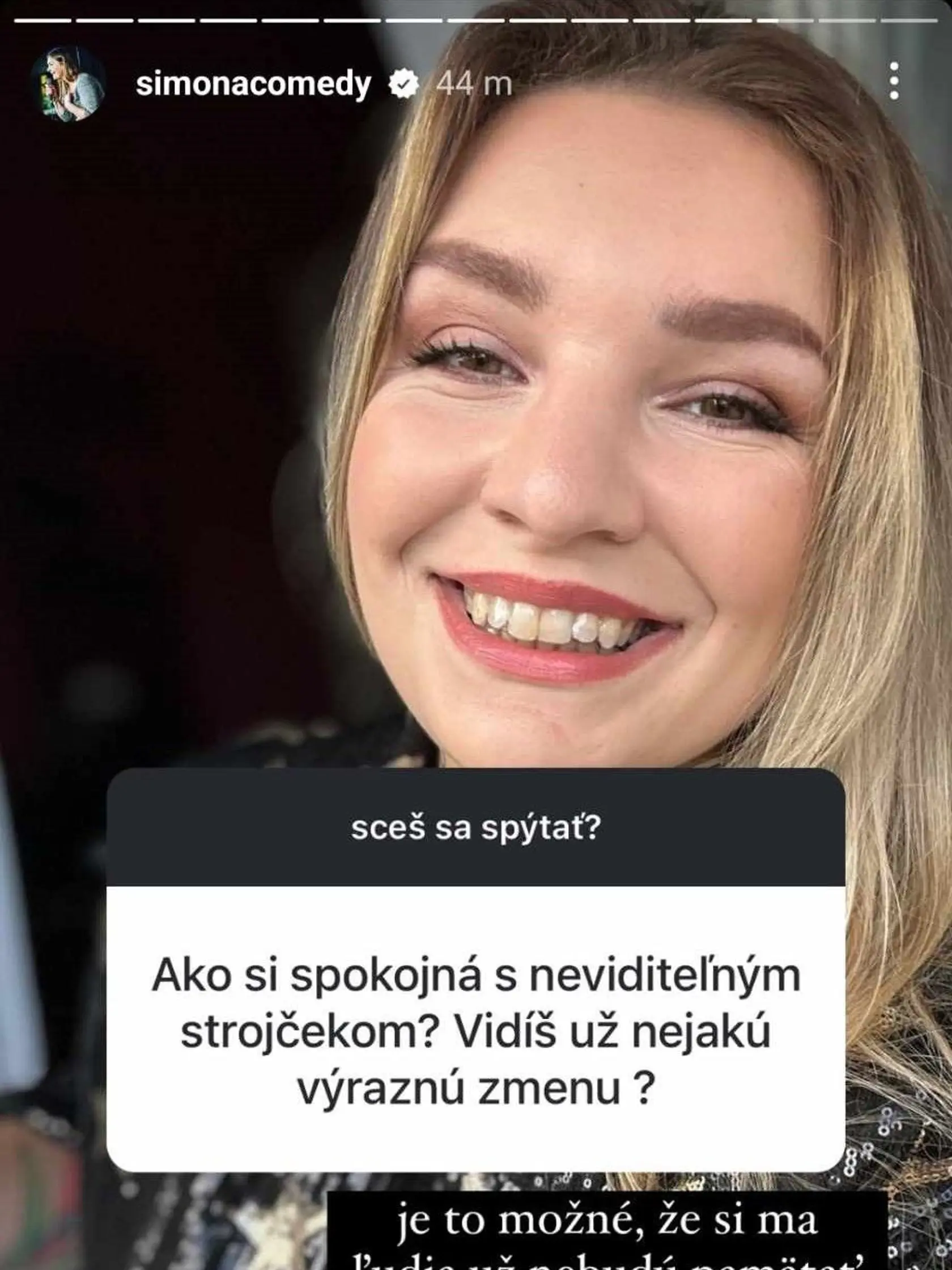 Simona sa po roku pýši hollywoodskym úsmevom.