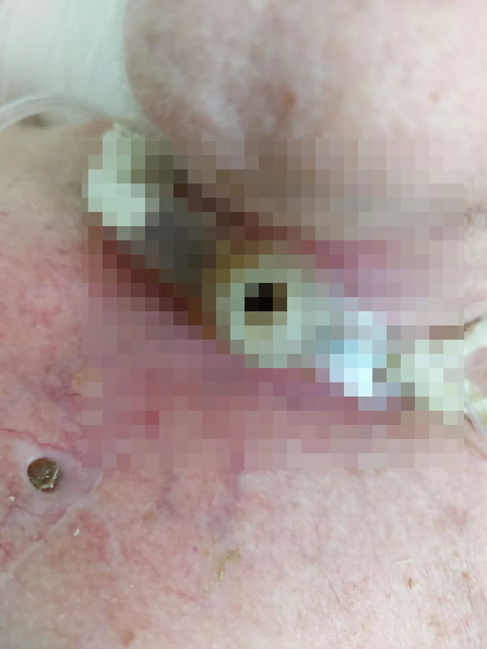 Na sociálnej sieti sa objavili fotografie z interného oddelenia bojnickej nemocnice. Práve tie mnohých poriadne šokovali. Je na nich znázornená pacientka v žalostnom stave.