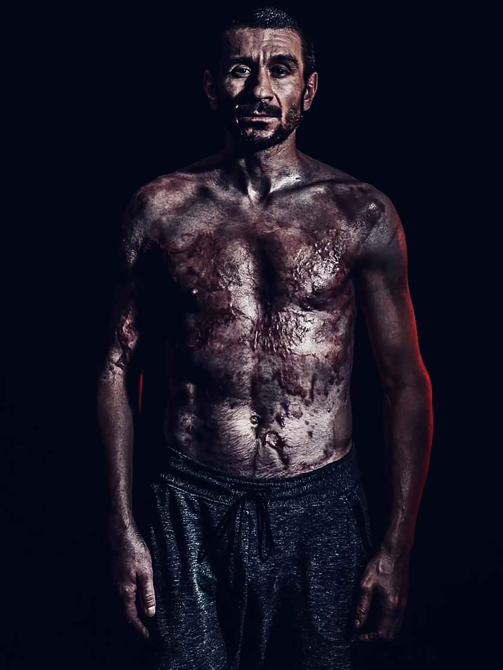 SUPERHRDINA Tanečník dnes už vtipkuje. Prirovnáva sa k mape alebo ku komiksovému hrdinovi Wolverinovi.