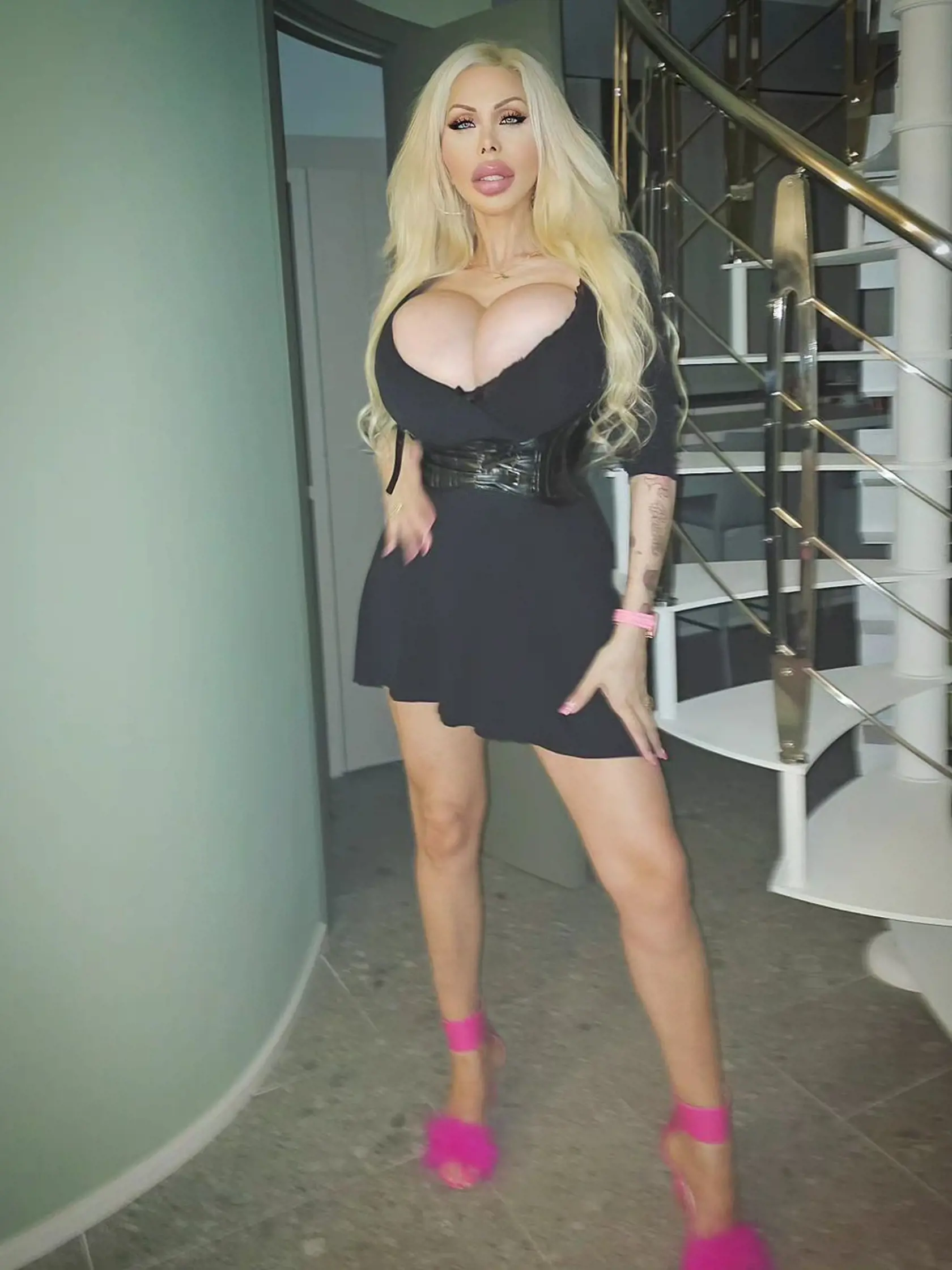Talianska modelka Ashley Kimberly Khloe Skönhet utratila za rôzne zákroky vyše 94 000 eur a svojim vzhľadom si získala takmer 200 000 fanúšikov na sociálnej sieti.
