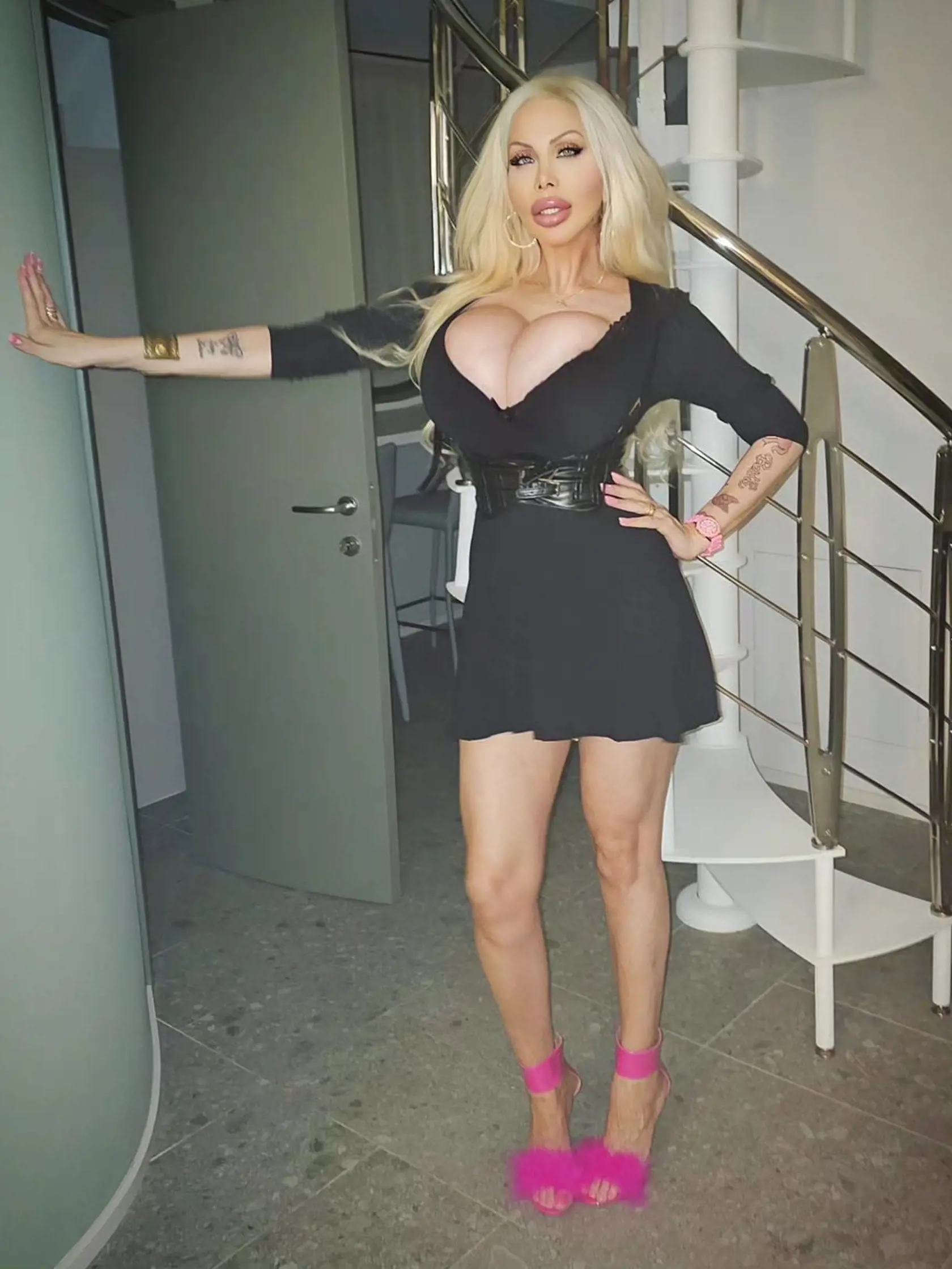Talianska modelka Ashley Kimberly Khloe Skönhet utratila za rôzne zákroky vyše 94 000 eur a svojim vzhľadom si získala takmer 200 000 fanúšikov na sociálnej sieti.