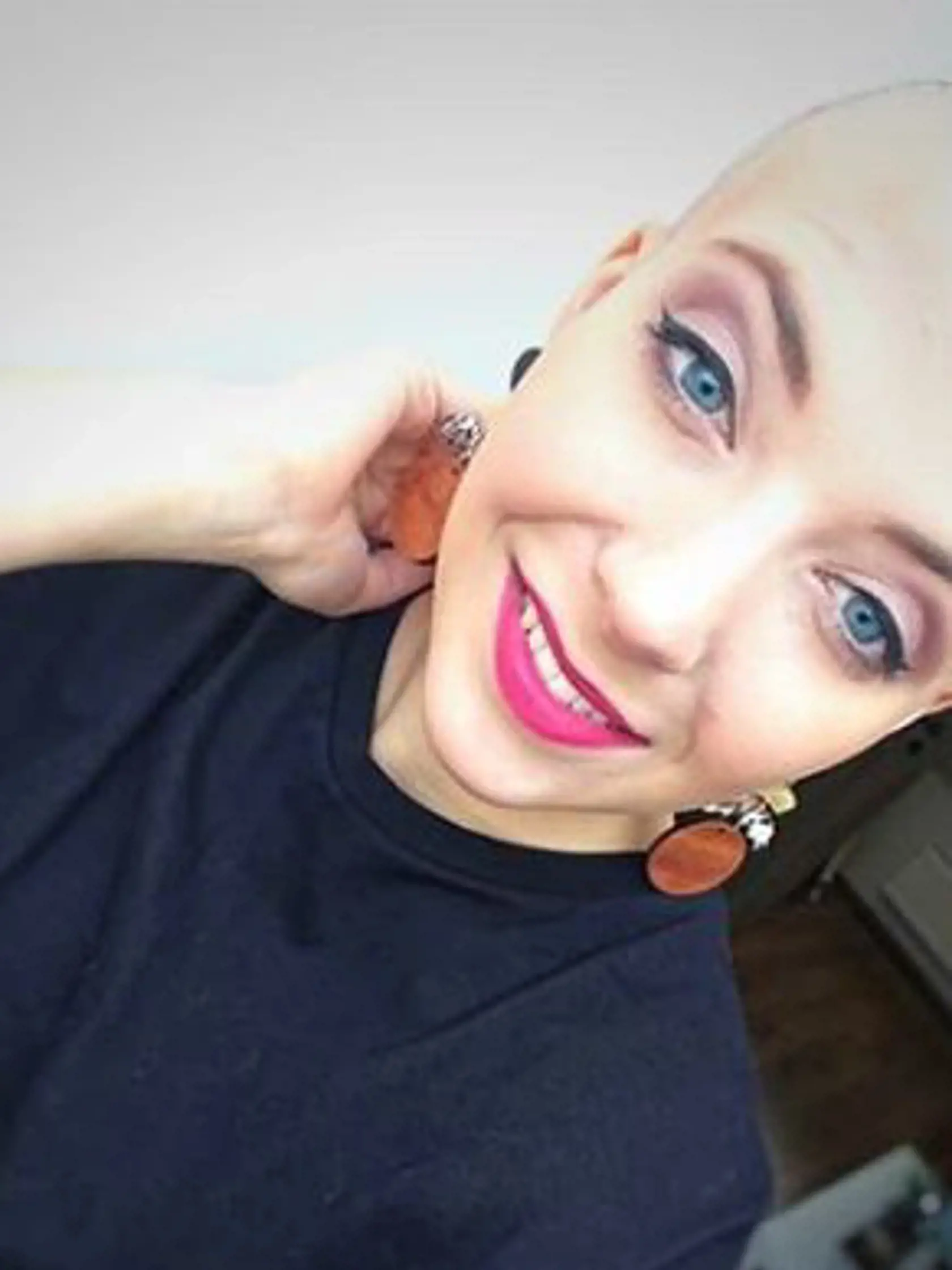 Anička si po prvej chemoterapii vyholila hlavu. Fotku zverejnila na svojom Instagrame.