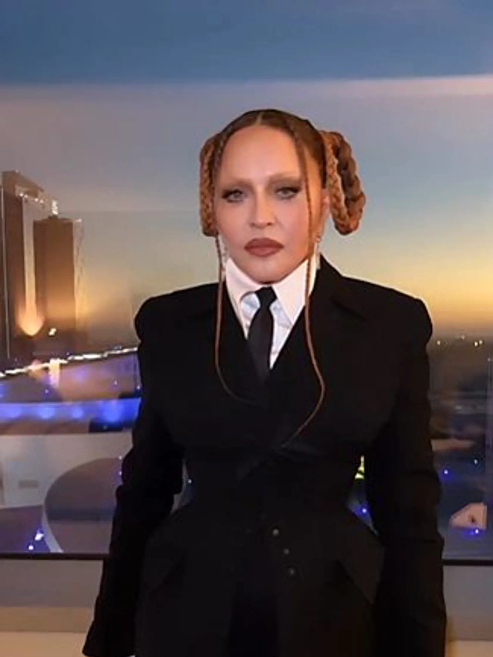 Madonna potom, čo šokovala svojím vzhľadom. Botox jej vraj už sadol a teraz vyzerá celkom inak.