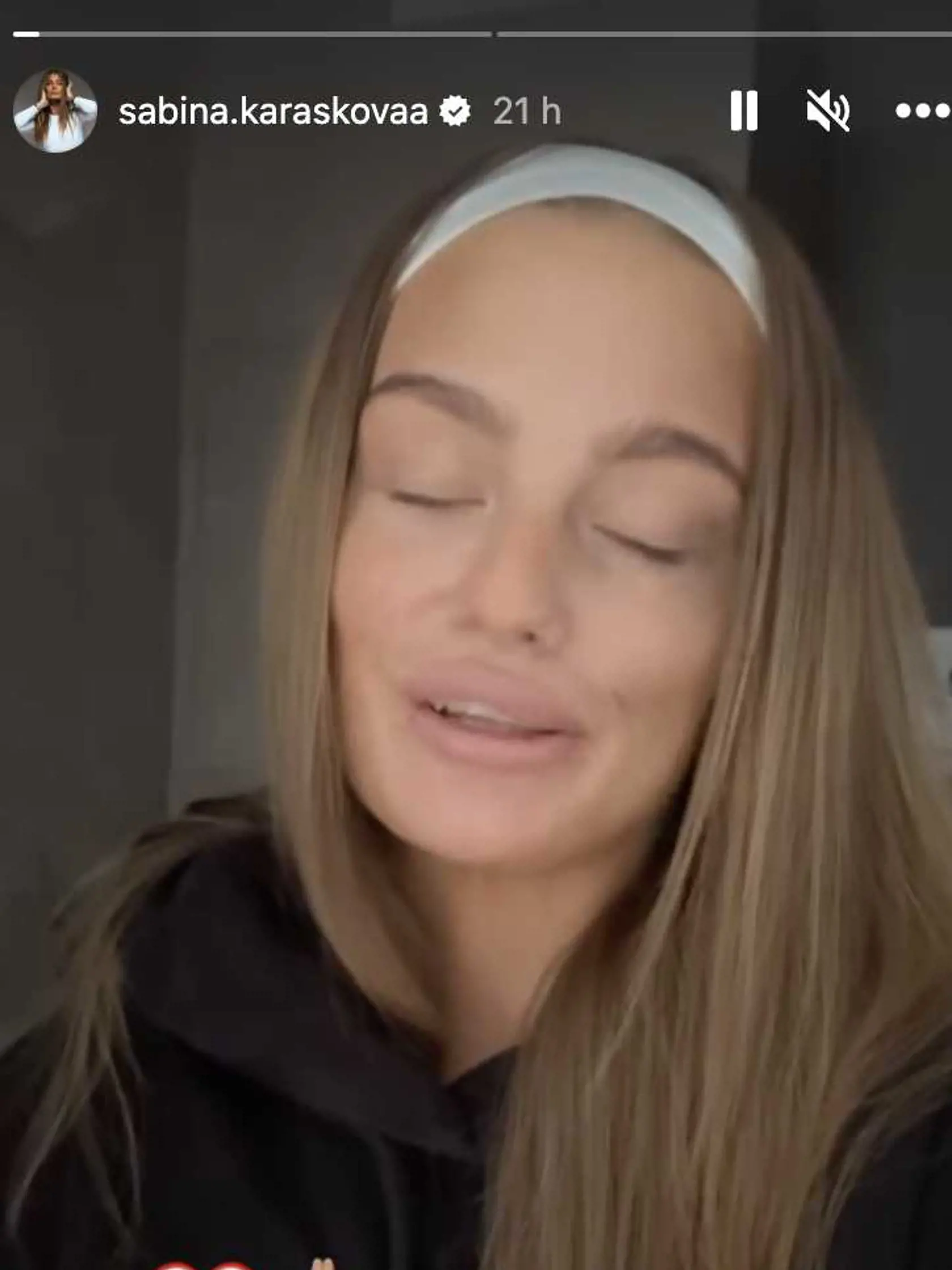 Sabina sa ukázala s modrinami na tvári