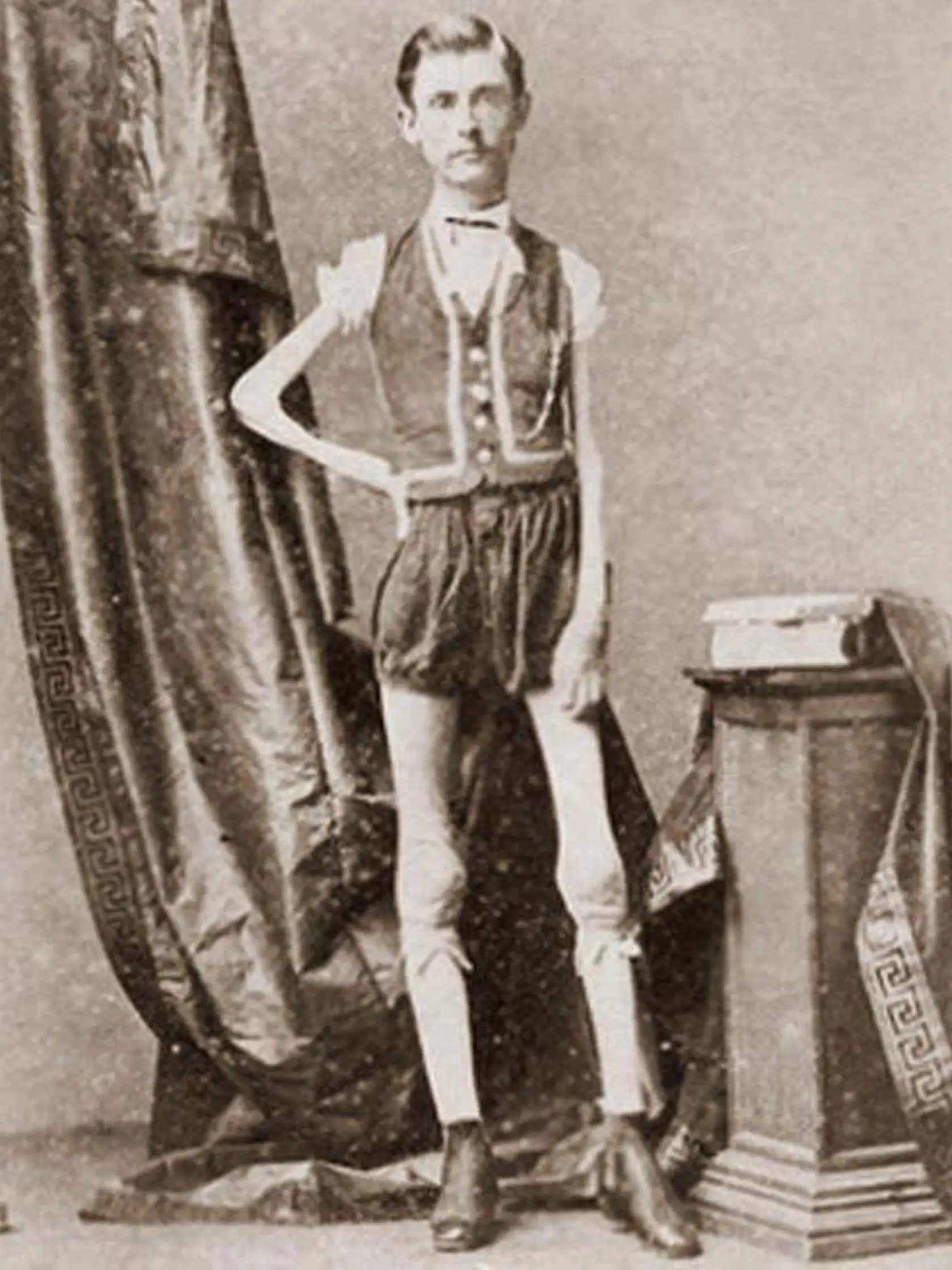 Isaac Sprague bol najznámejší ako najchudší muž na svete. Diagnózou, ktorá mu nedovoľovala pribrať ani kilo trpel už od útleho veku. Podarilo sa mu založiť rodinu, žiadne z jeho detí však zákerným ochorením netrpelo. Zomrel vo veku 36 rokov.