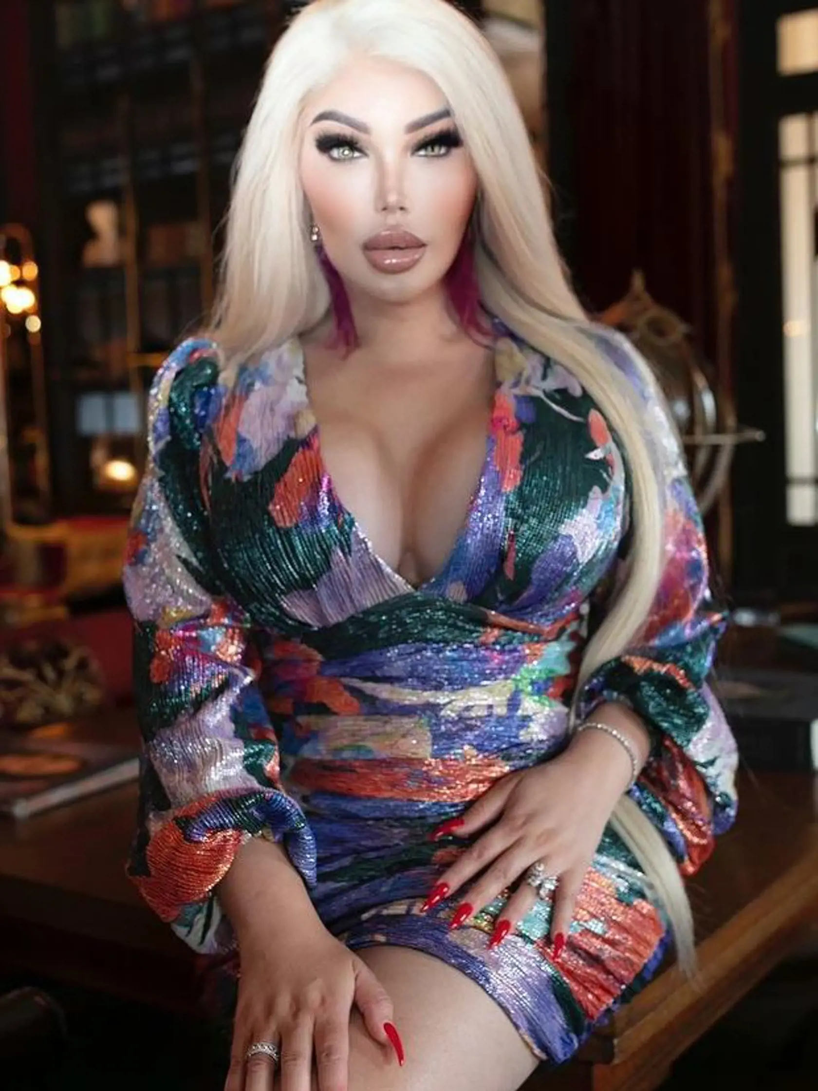 Najznámejšia živá Barbie na svete Jessica Alves (37), ktorá bola nedávno ešte mužom Rodrigom, neprestáva svojimi premenami šokovať. Aby si splnila sen a stala sa živou Barbie, podstúpila zmenu pohlavia, dala si chirurgicky upraviť tvár, nos, podstúpila zmenšenie žalúdka aj liposukciu.