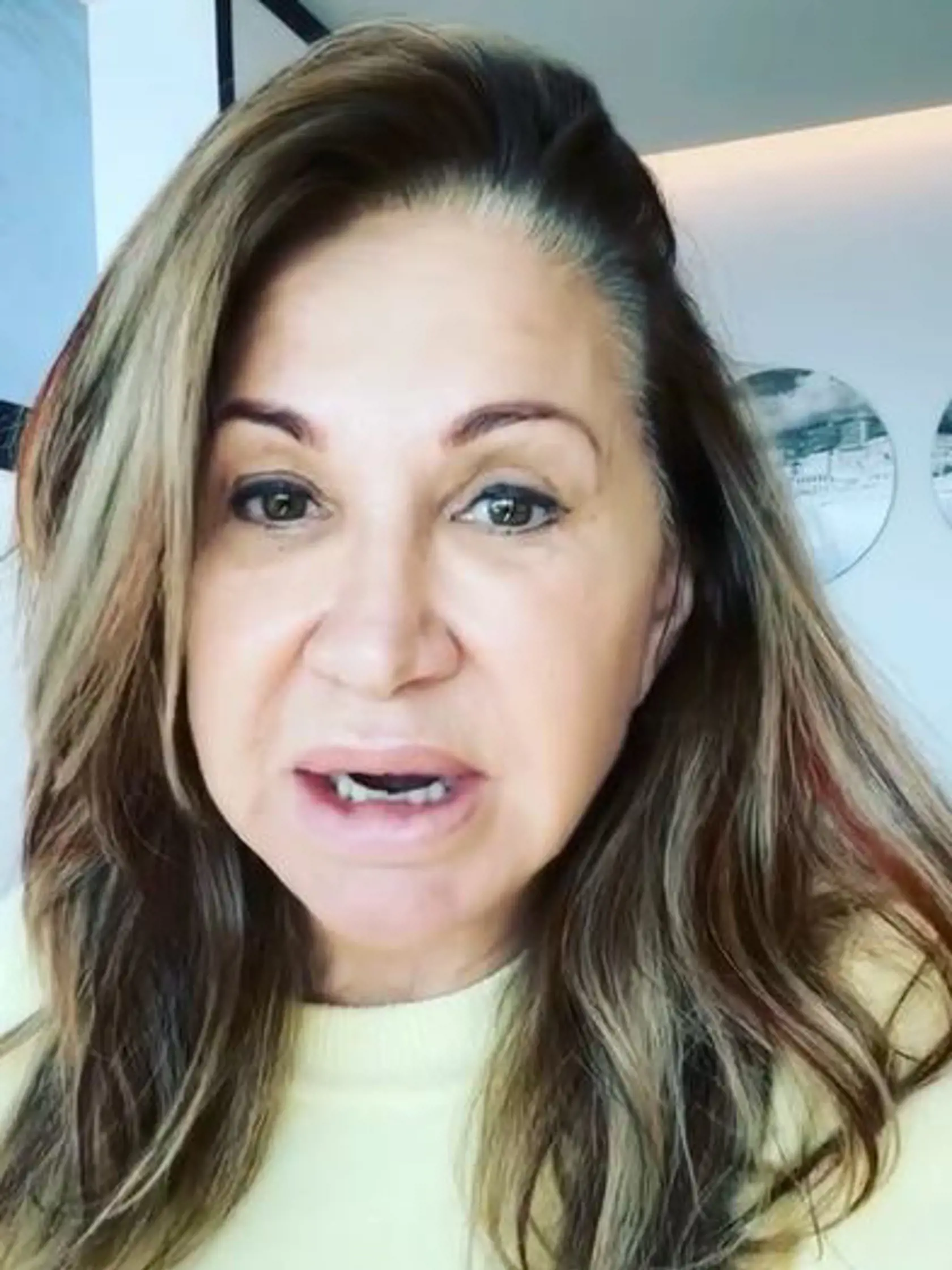Na jej tvári sú viditeľné vrásky, pleť je ochabnutá a jej oči pôsobia opuchnuto. Milionárka bola pri tom už v minulosti kritizovaná za nadmerné používanie fotografických filtrov, ktorými si neuberala len vek, ale občas ak kilá navyše.