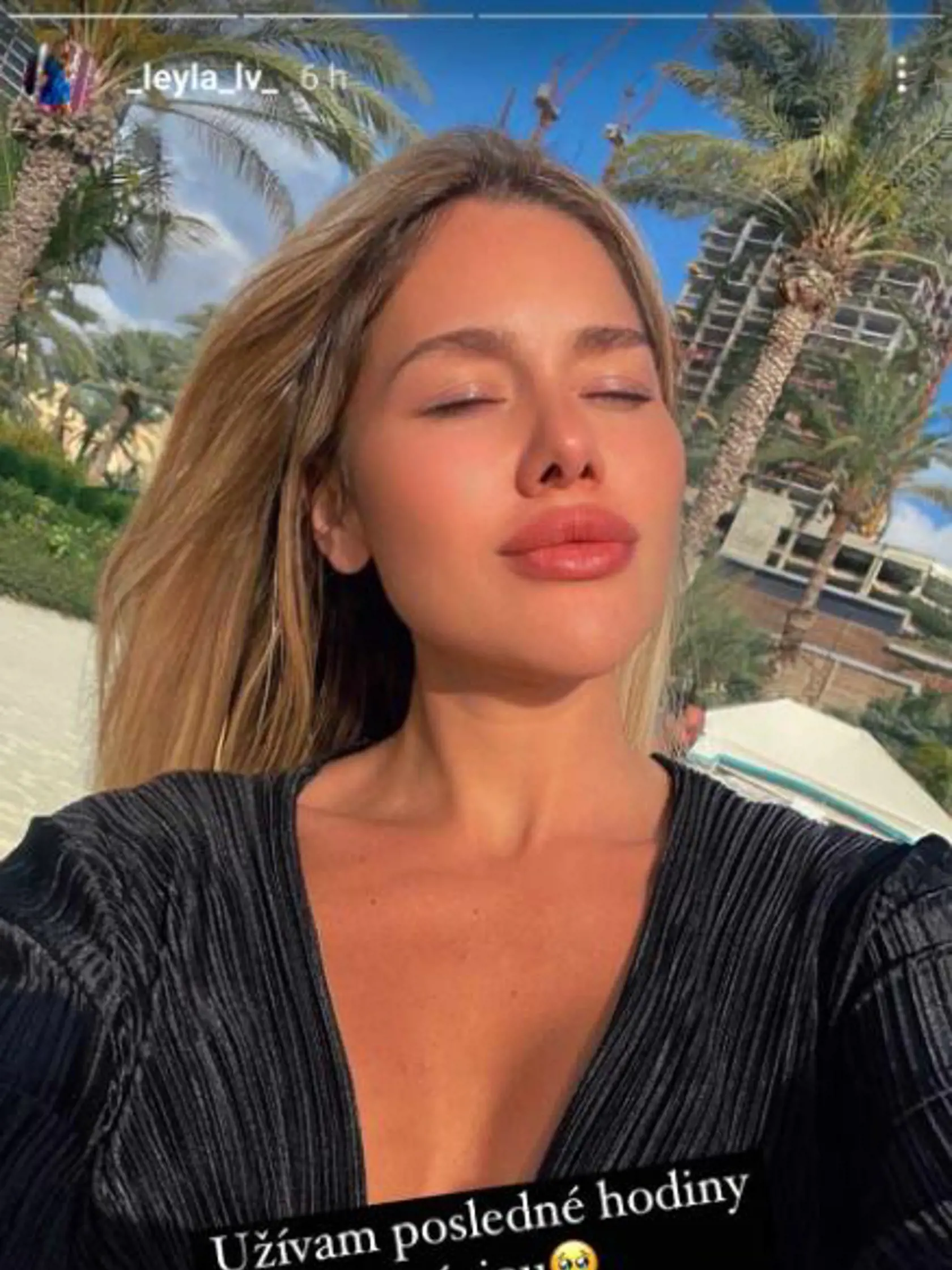 Laura VIzváryová podstúpila v DUbaji operáciu nosa.