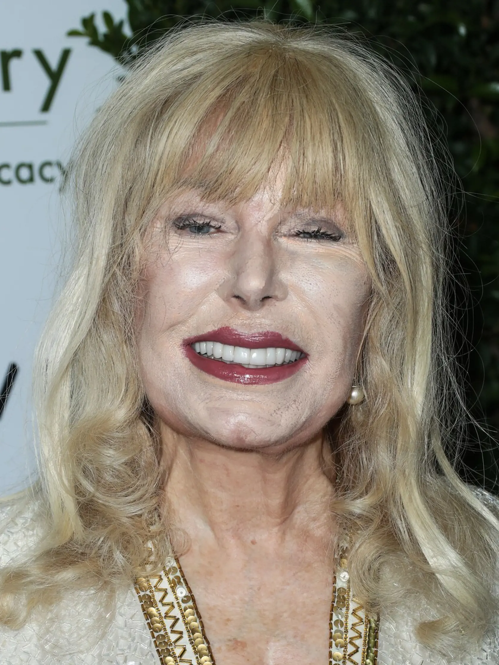 Loretta Swit časom prepadla plastickým operáciám a kozmetickým zákrokom. A ako sa dá tušiť, čoho je veľa, toho je príliš. Herečka sa o svoju krásu nakoniec nedobrovoľne pripravila sama a zmenila sa takmer na nepoznanie.