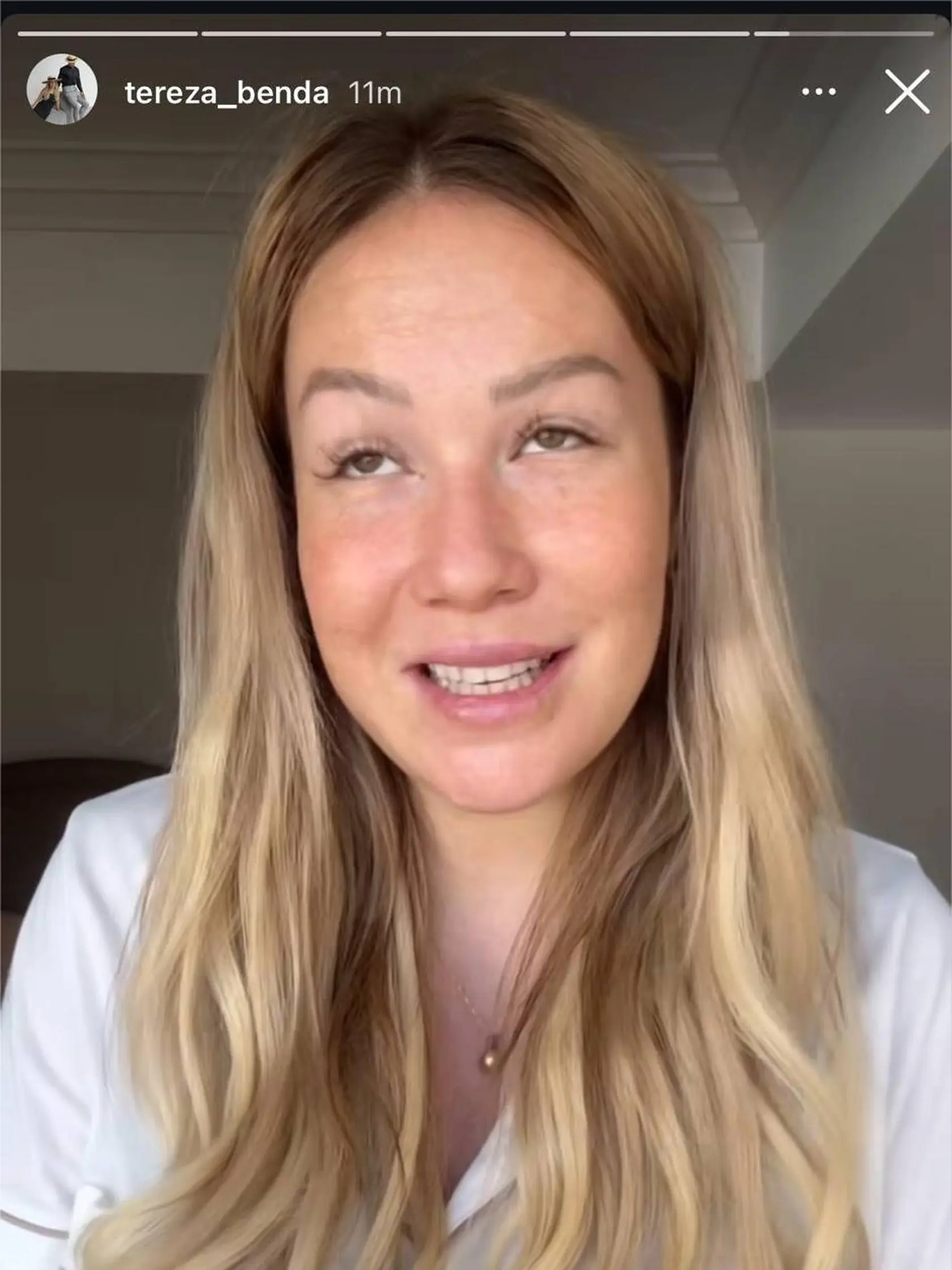 Tereza Benda prehovorila o sume za pôrod