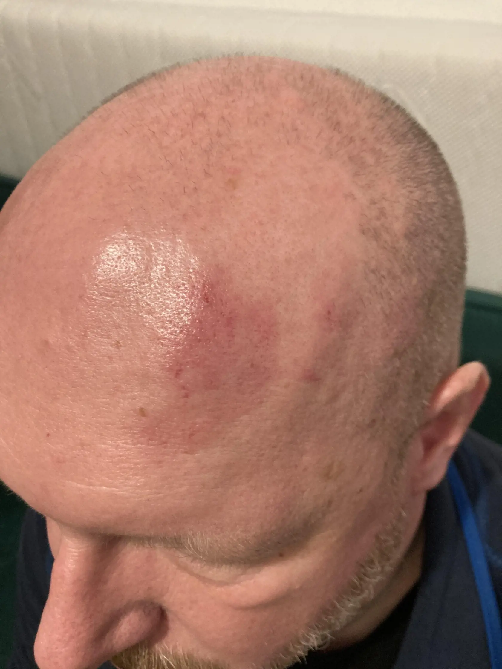 Zranenia pána Vlastimila po brutálnom policajnom zákroku.