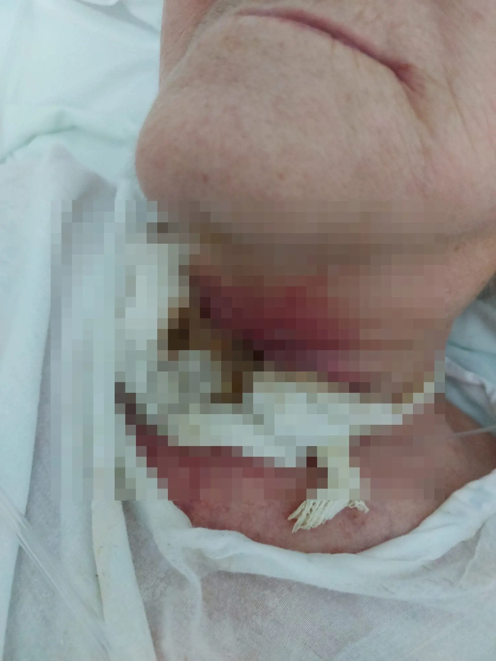 Na sociálnej sieti sa objavili fotografie z interného oddelenia bojnickej nemocnice. Práve tie mnohých poriadne šokovali. Je na nich znázornená pacientka v žalostnom stave.