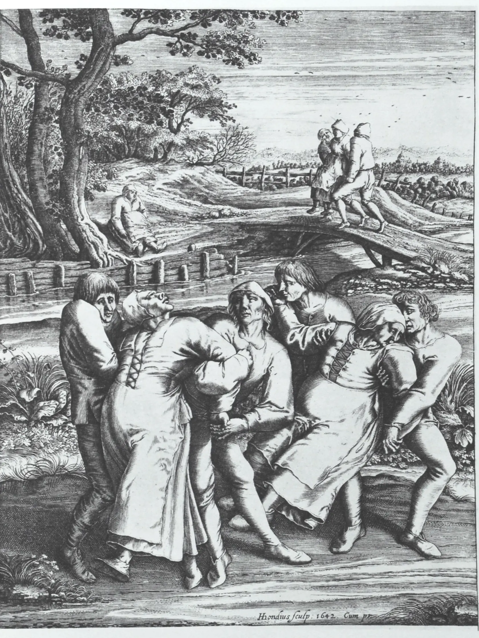 Viete, že zomrieť sa dá aj na...tanec? Ide o reálny prípad z júla roku 1518, kedy vo francúzskom Štrasburgu vypukla tanečná epidémia. Nejde o žiadny nadnesený pojem – až 400 nakazených ľudí nekontrolovateľne tancovalo až do úmoru, mnohí jednoducho zomreli na porážky, infarkty a vysilenie organizmu. Mestská radnica dokonca pre chorých postavila pódium a najala hudobníka v domnienke, že tým urýchli proces liečenia.