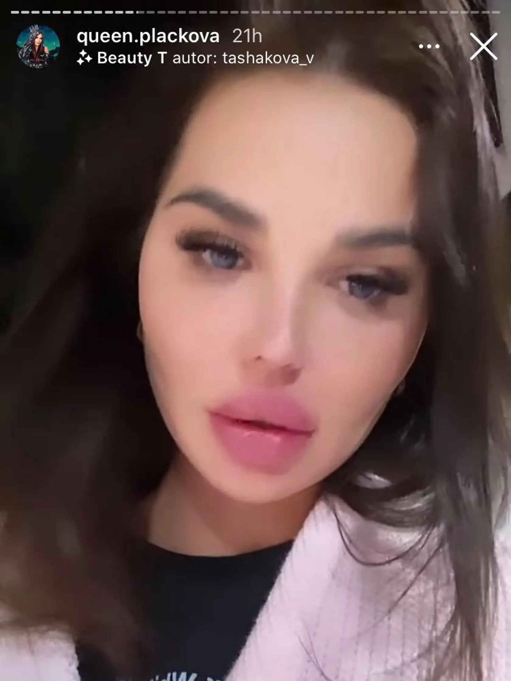Plačková to v Jasnej prehnala s alkoholom a točila videá, ktoré neskôr zmazala.