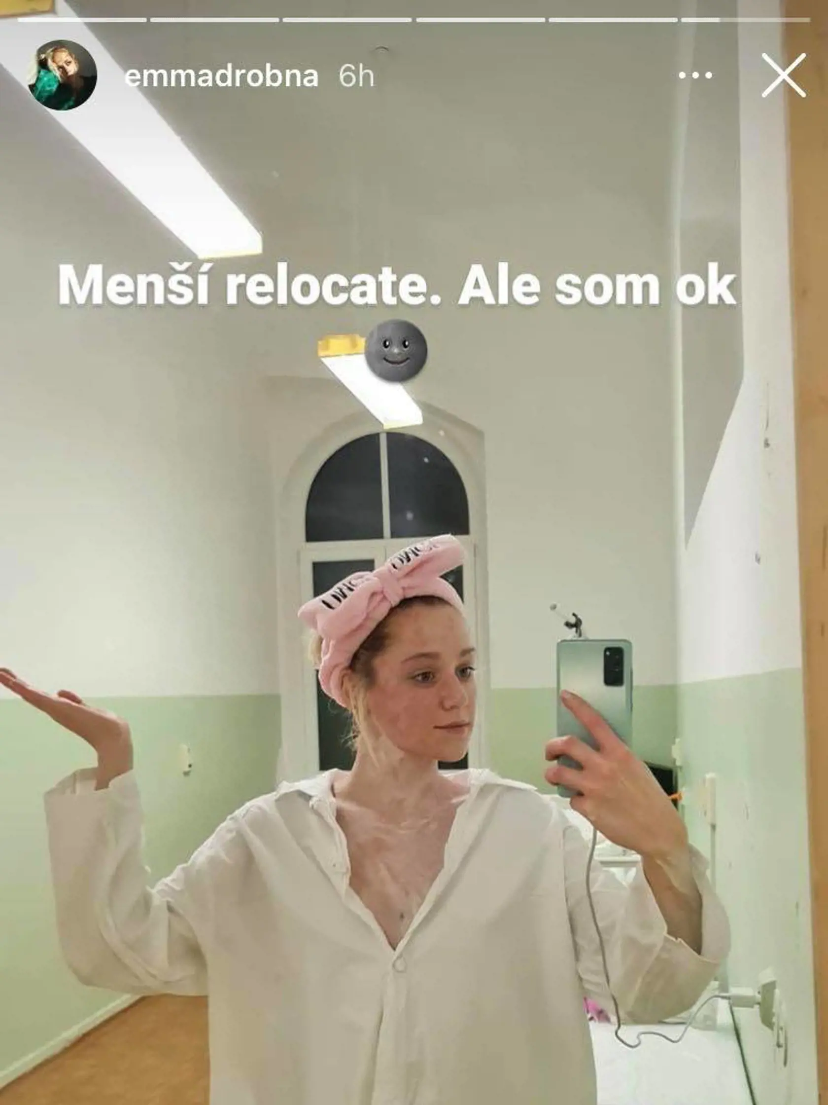 Emmu Drobnú postihla silná reakcia na tvári.