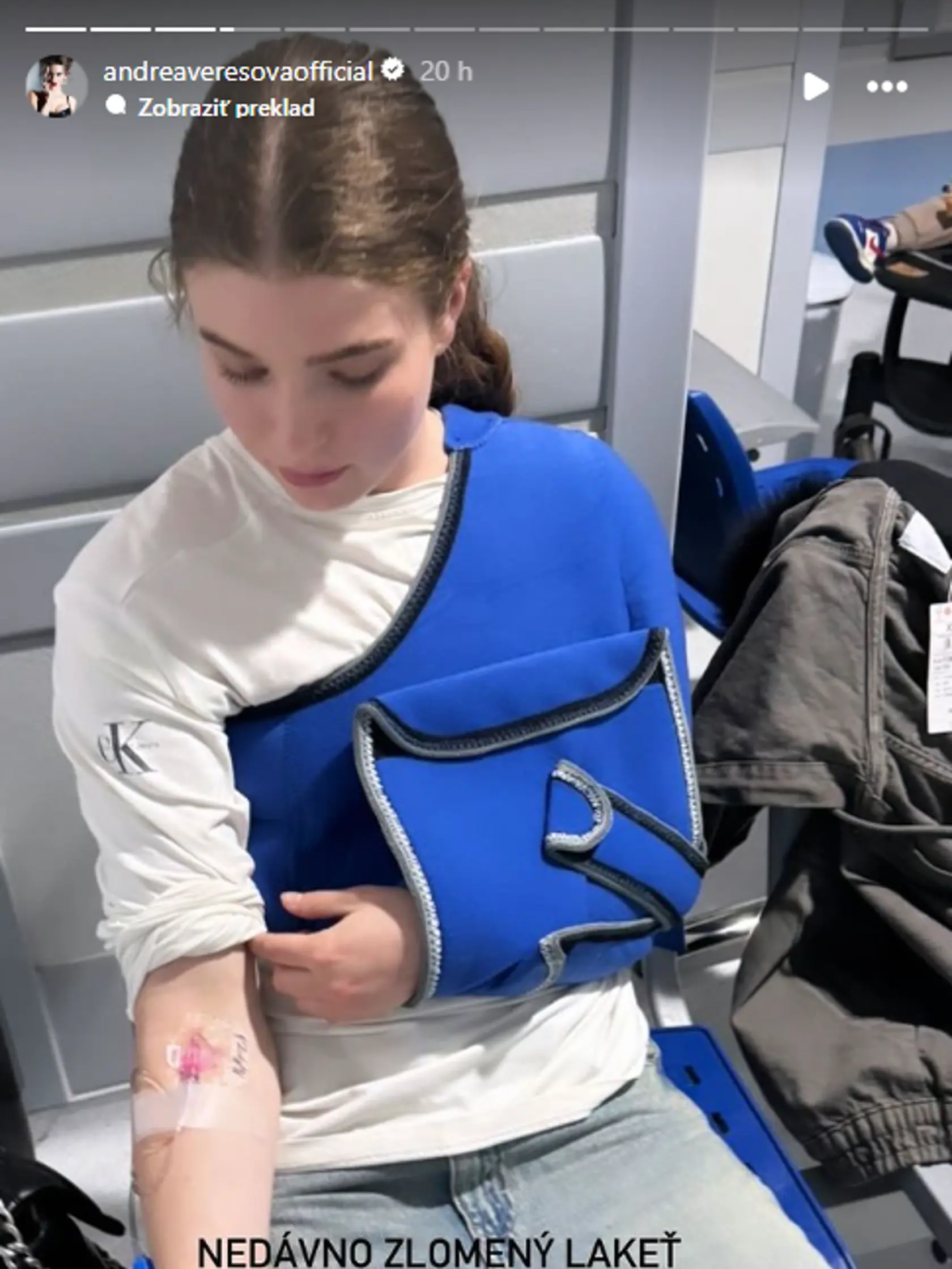 Verešovej dcéra Vanessa si zlomila kľúčnu kosť.