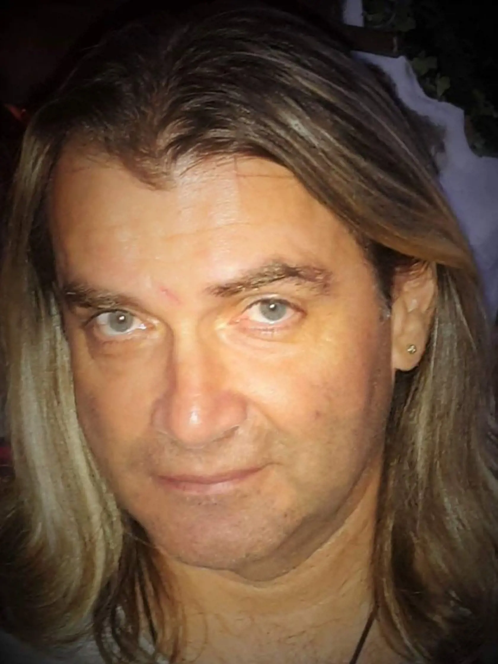 Braňo Mojsej (51), ktorý sa sám v minulosti liečil, mu posiela svoje rady.