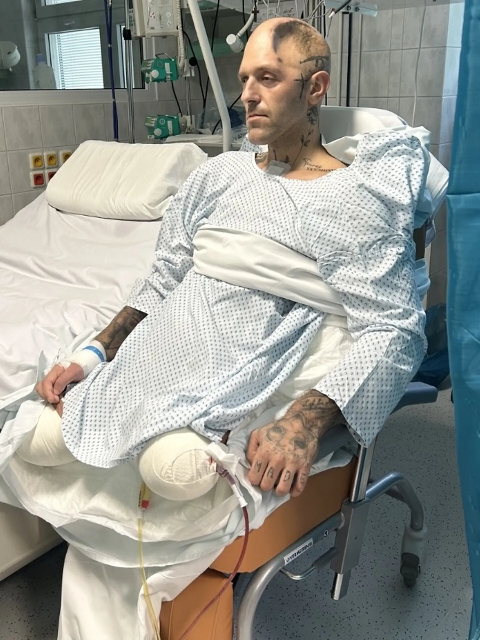 Lekári najprv tvrdili, že neprežije. V najlepšom prípade ostane v bdelej kóme.