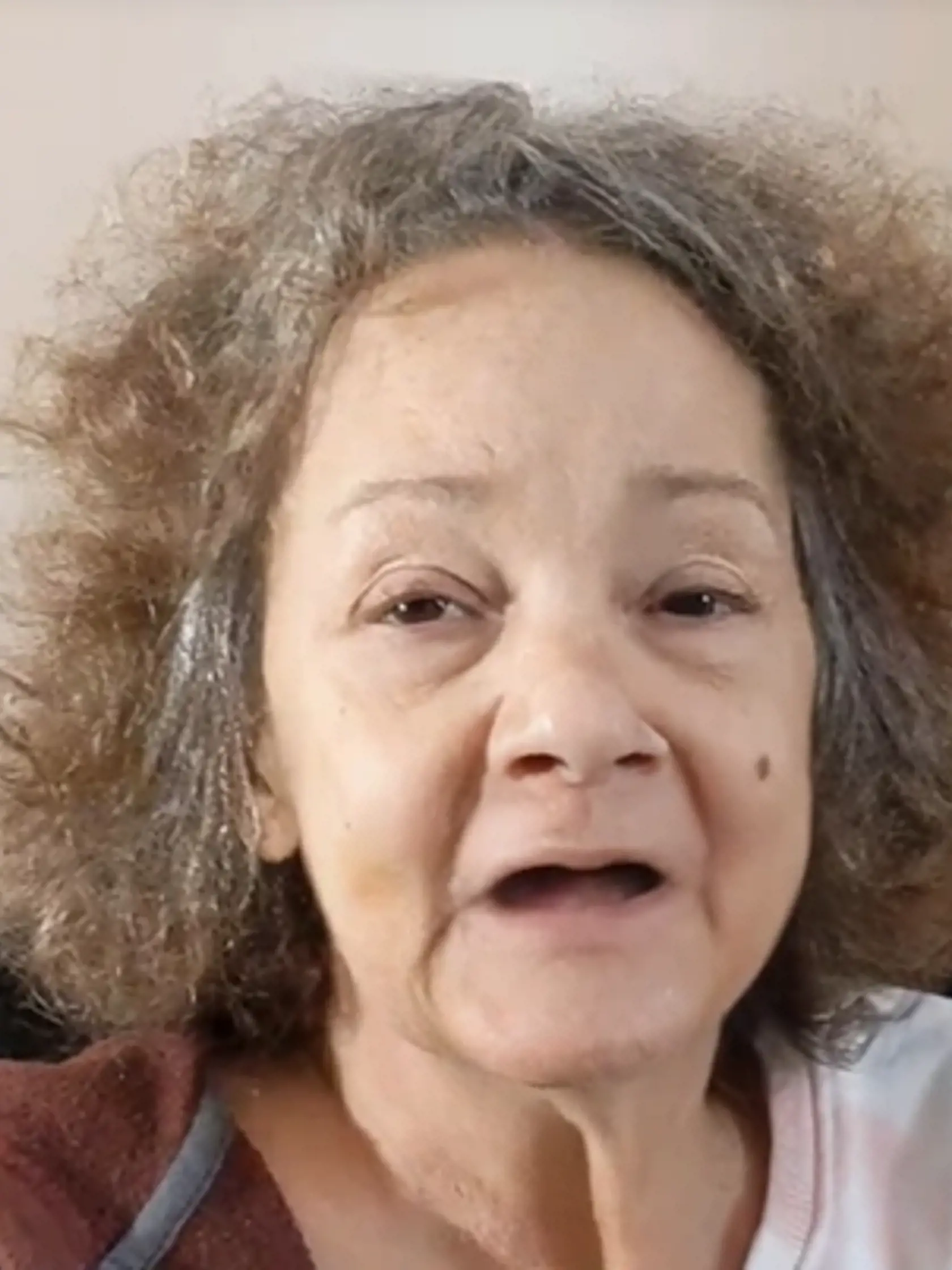 Sestra Mariah Carey, Alison. Žena nemá zuby a na jedlo si zarábala prostitúciou. za všetko vraj môže trauma z detstva.