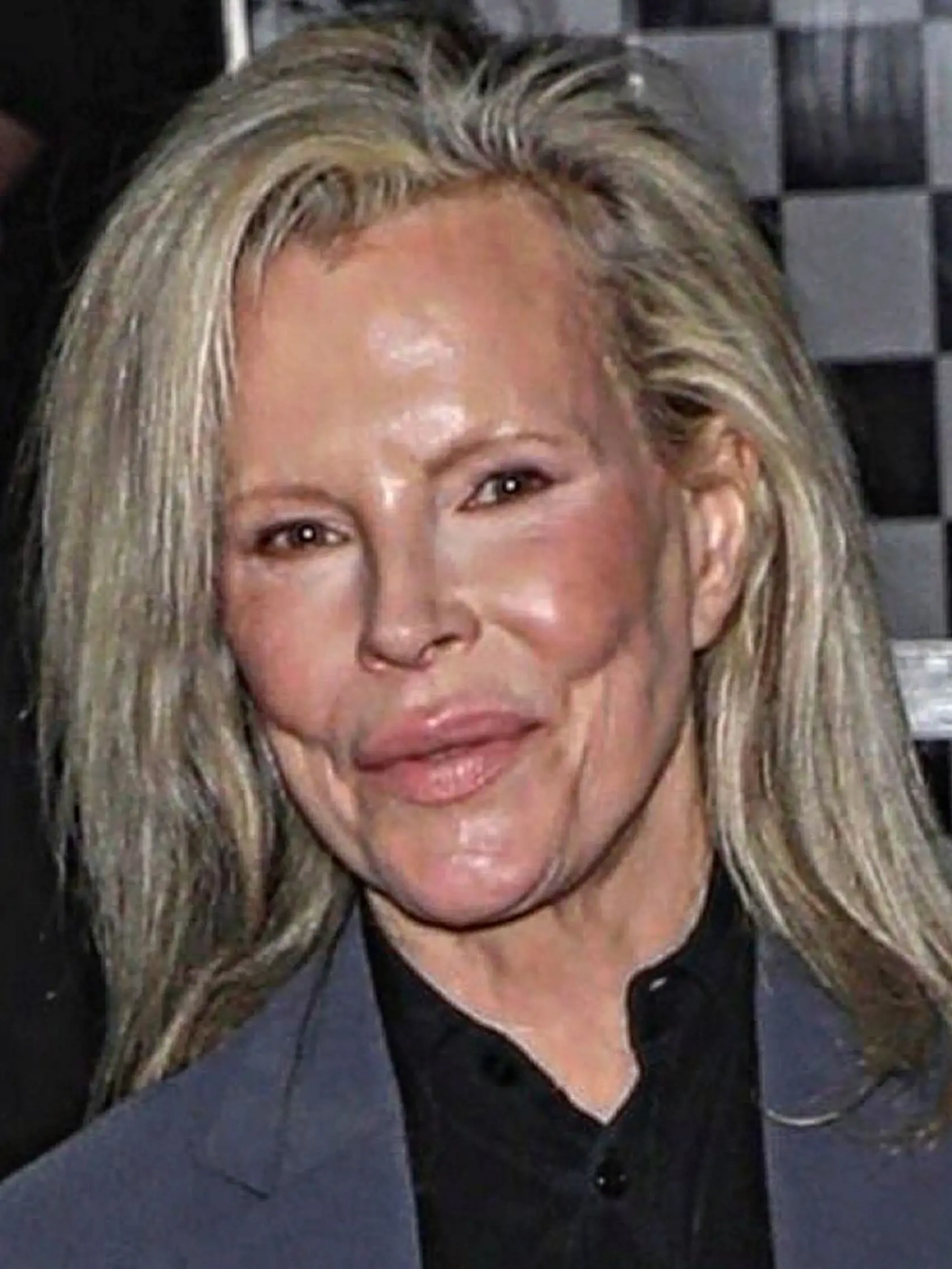Kim Basinger verejne žiadne zásahy plastických chirurgov nepriznala, fotky však hovoria niečo iné.
