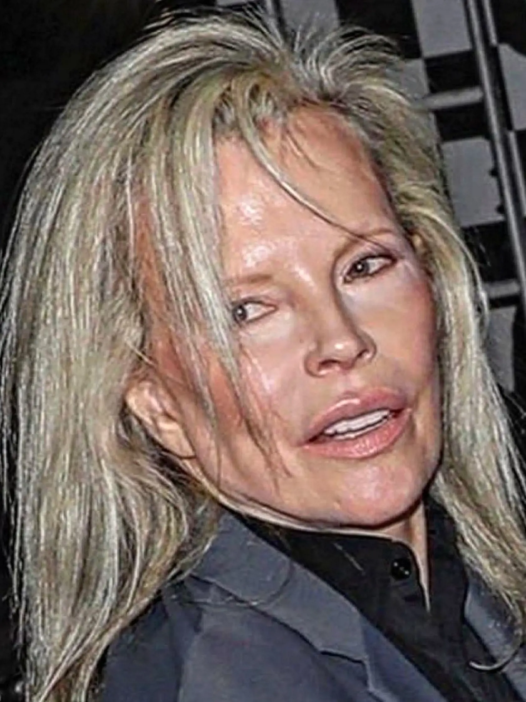 Kim Basinger verejne žiadne zásahy plastických chirurgov nepriznala, fotky však hovoria niečo iné.