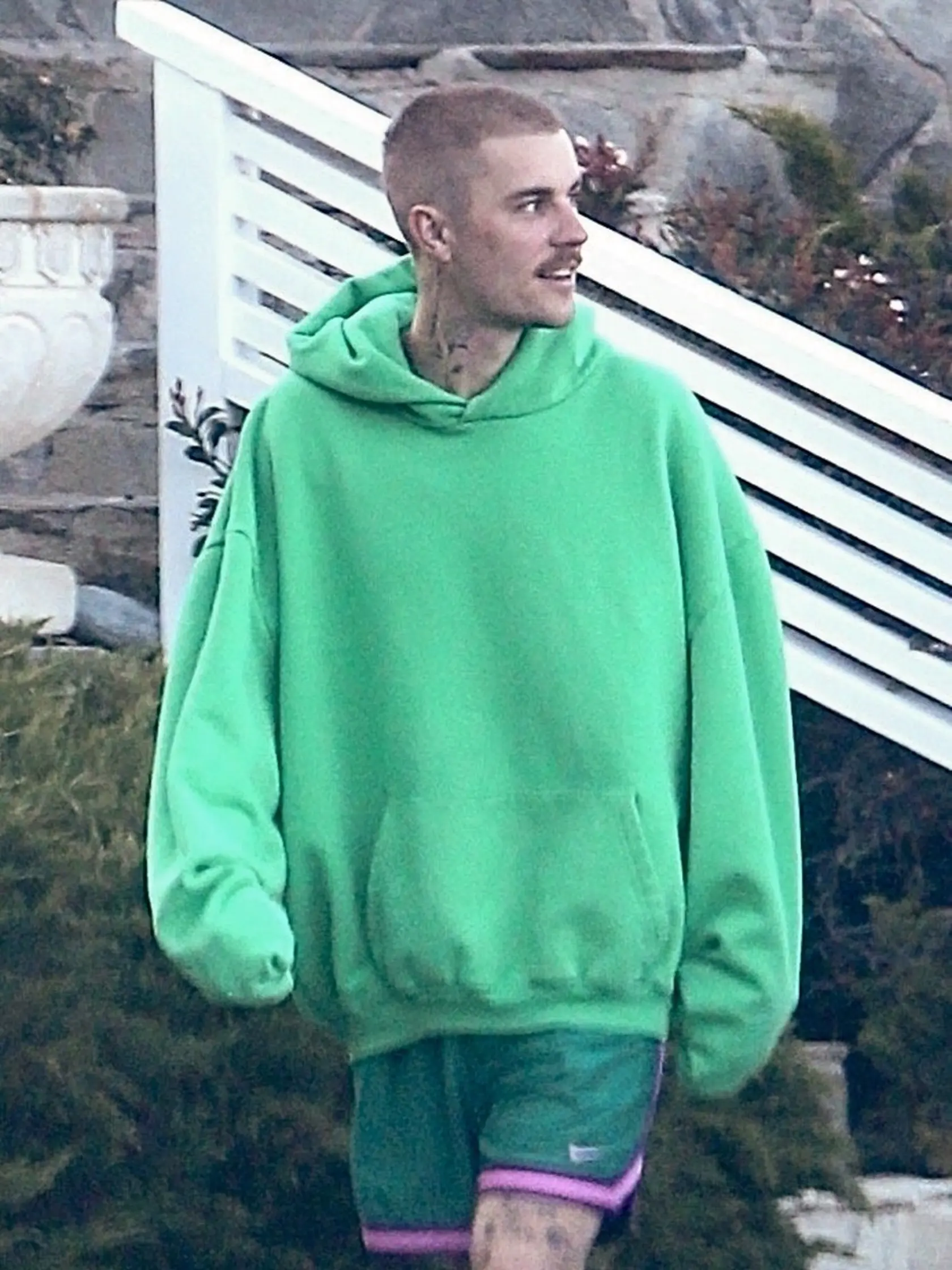 Plastický chirurg Dr. Gary Linkov naznačil, že spevák Justin Bieber podstúpil transplantáciu vlasov. Tu už mu „kúty“ nevidieť. 