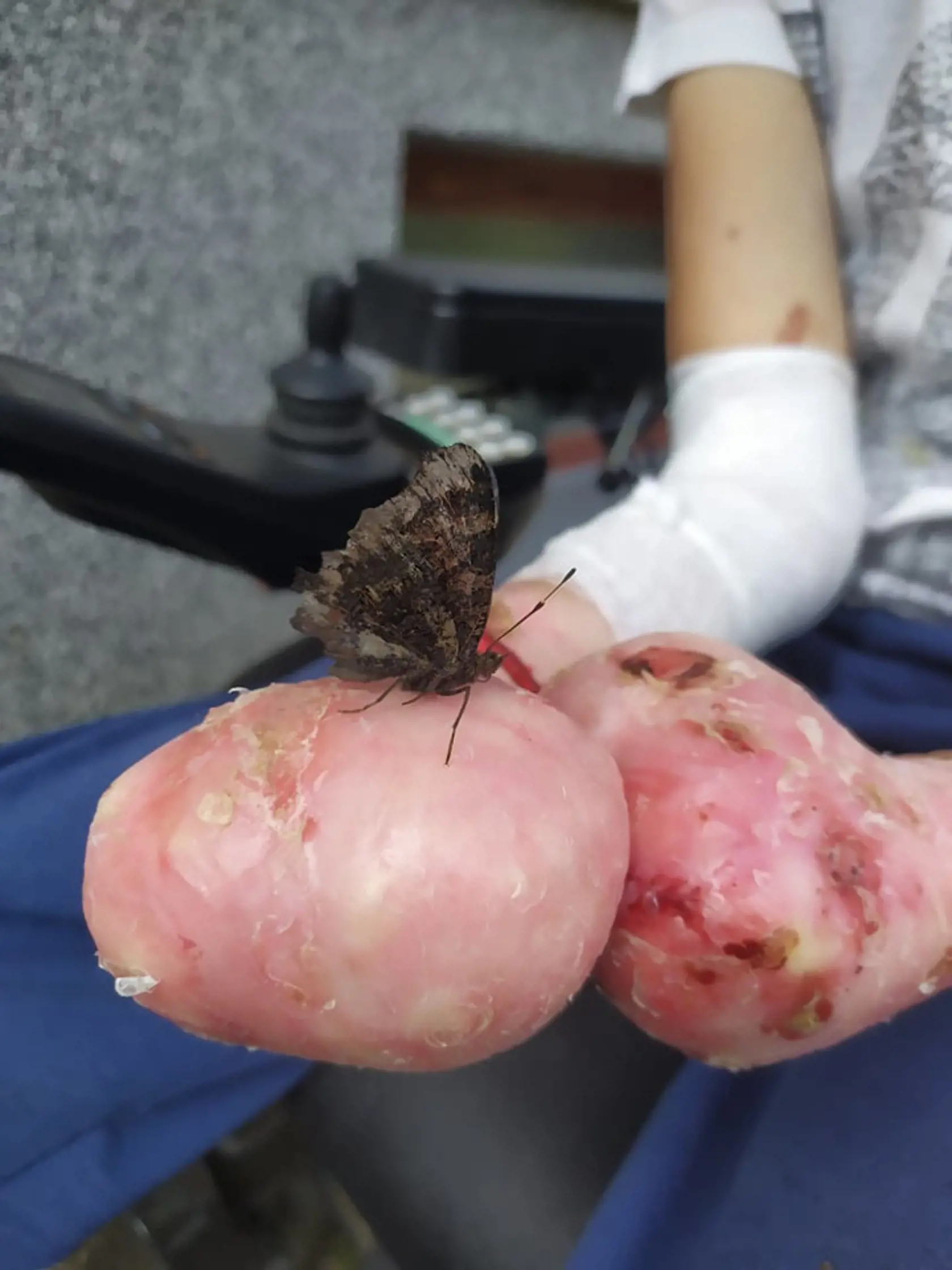 Poznáte diagnózu ľudovo nazývanú choroba motýlích krídel? Majko s ňou každý deň zvádza boj...