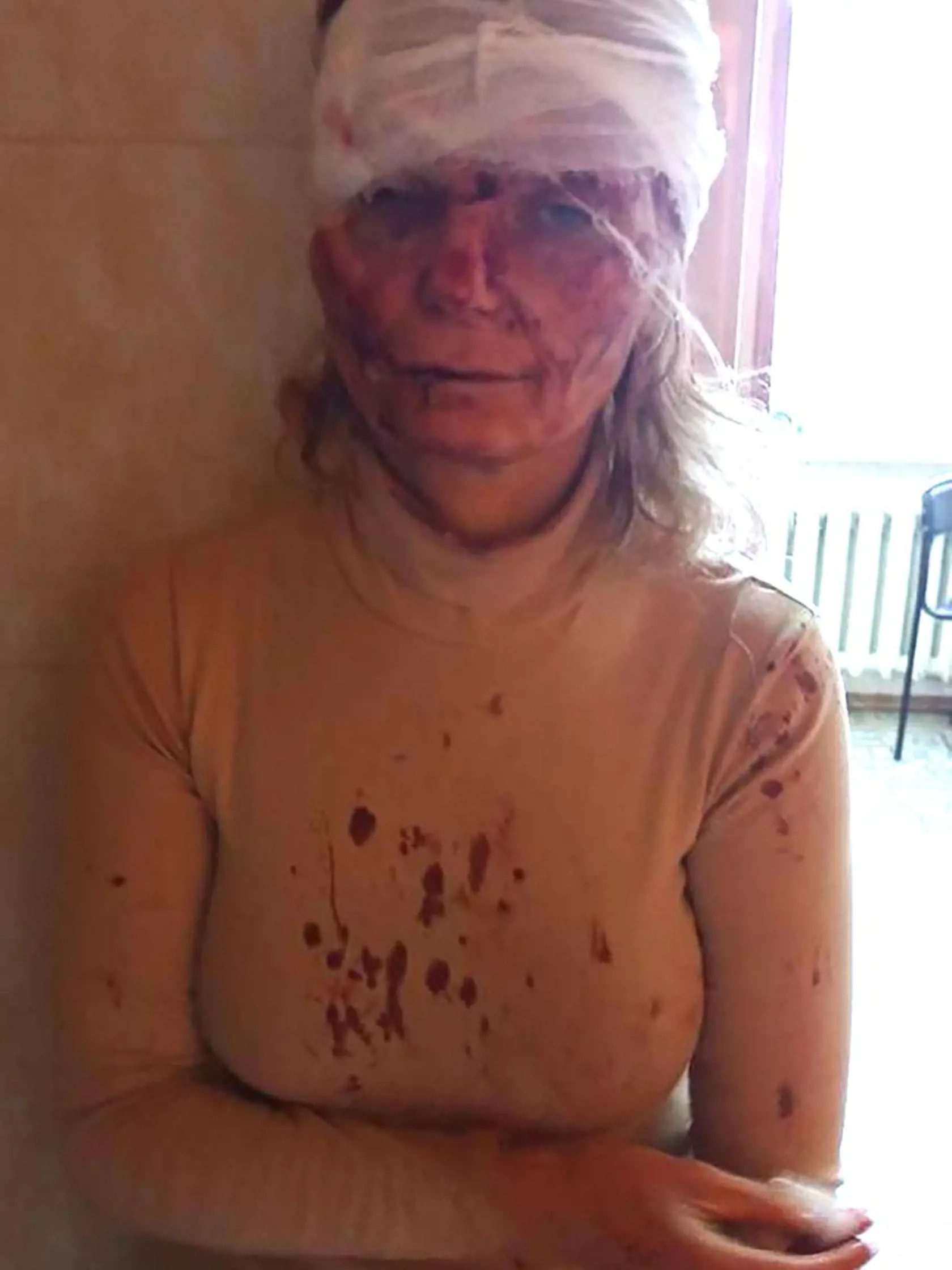 Olena Kurilo (52) tesne po bombardovaní.