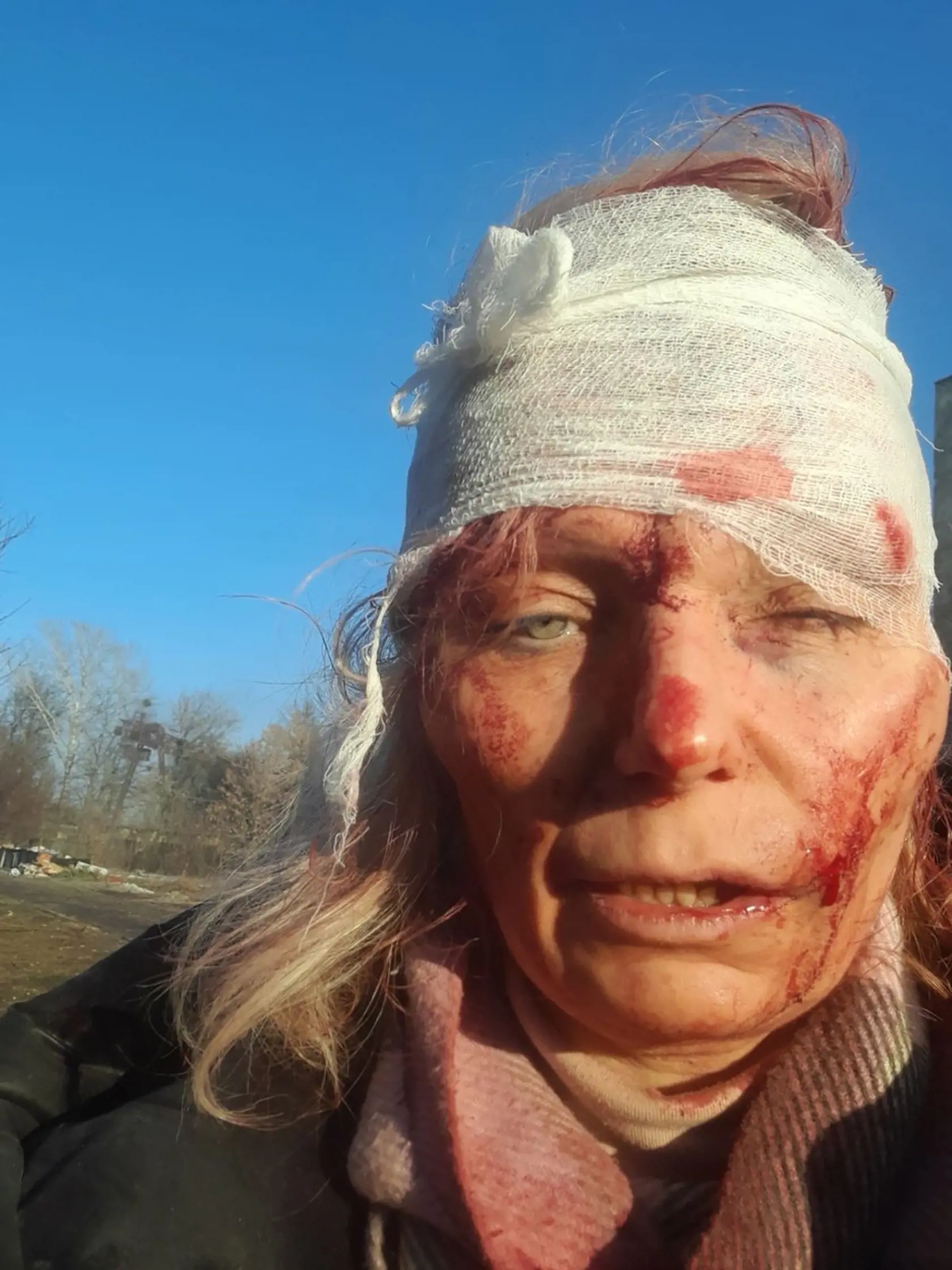 Olena Kurilo (52) tesne po bombardovaní.
