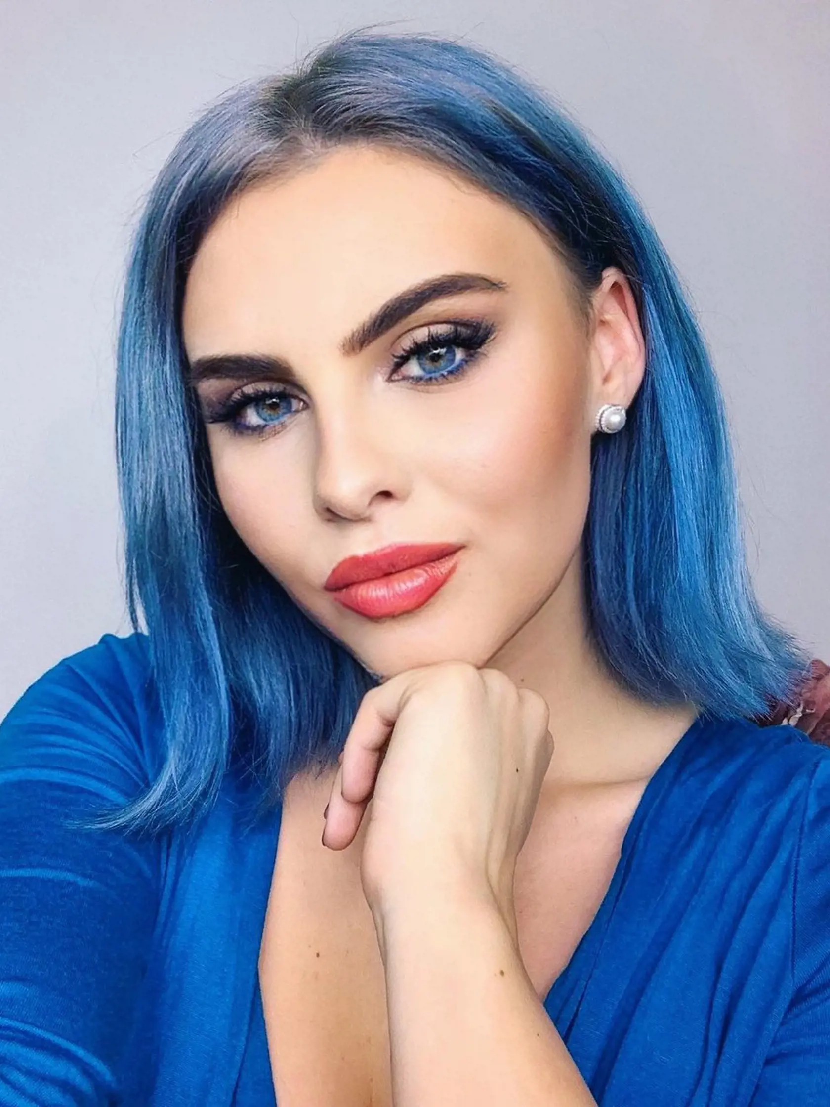 Influencerka Jana Hrmová nemá takéto plné pery od narodenia, pomohla si estetickou medicínou