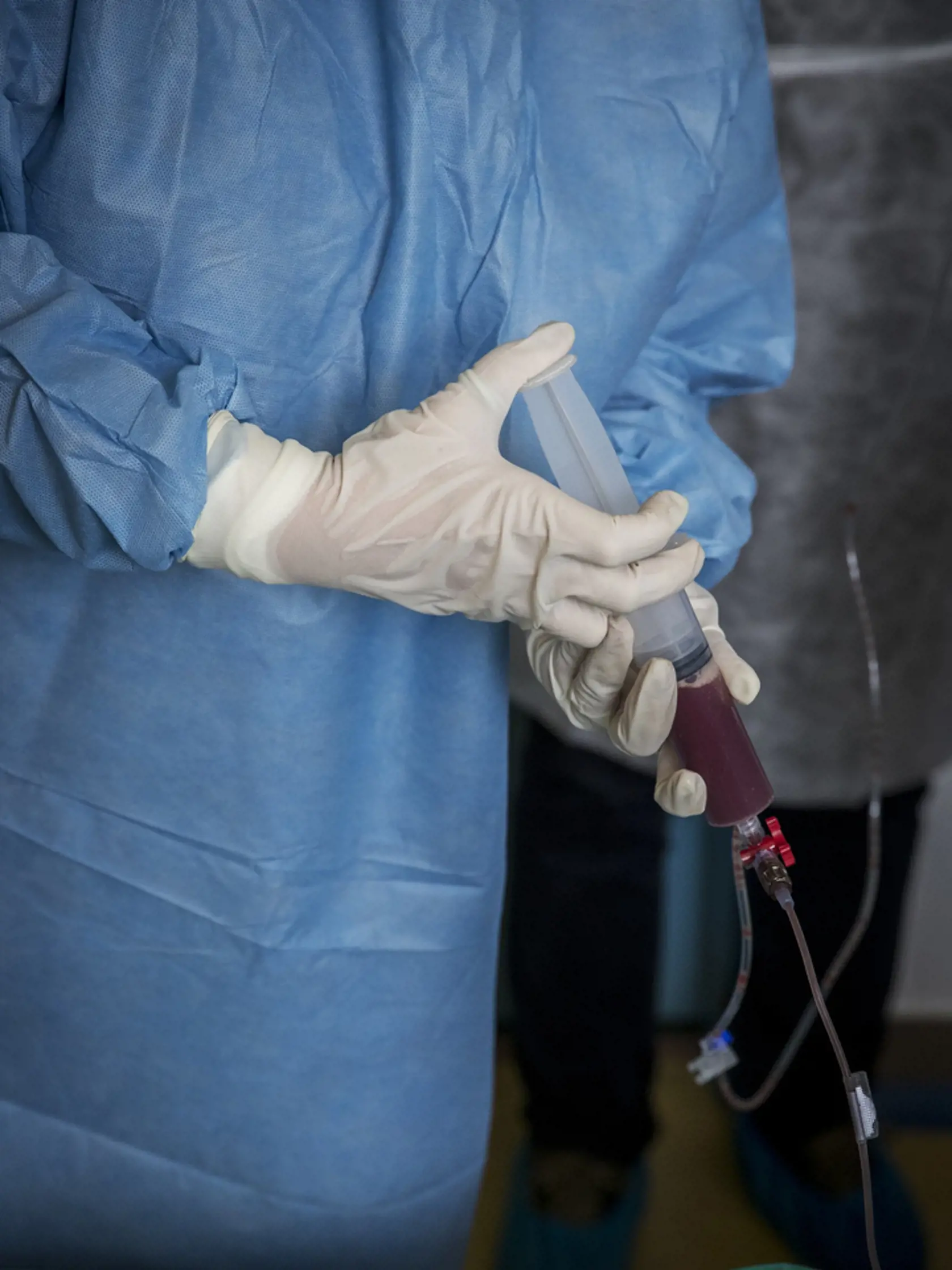 Transplantácia krvi vyzerá ako transfúzia.