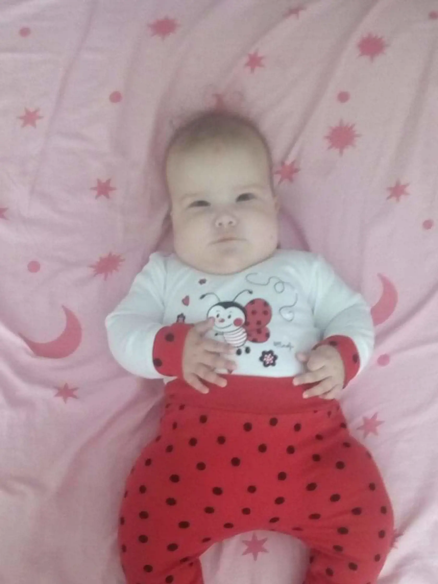 Sofia (4) sa narodila so štvorkomorovým hydrocefalom a rázštepom chrbtice.
