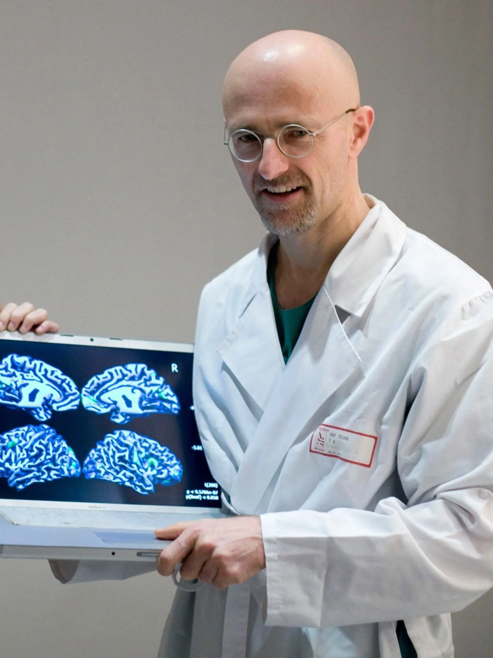 Kontroverzný taliansky profesor Sergio Canavero.