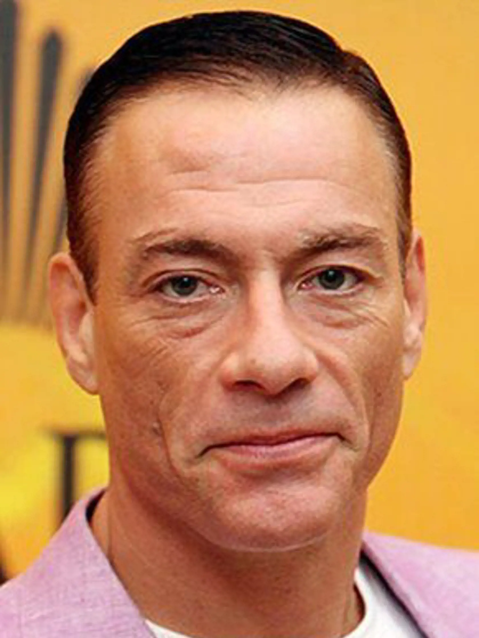 Jean Claude Van Damme a jeho tuková hrča na čele. Tá je už minulosťou, nechal si ju odstrániť.