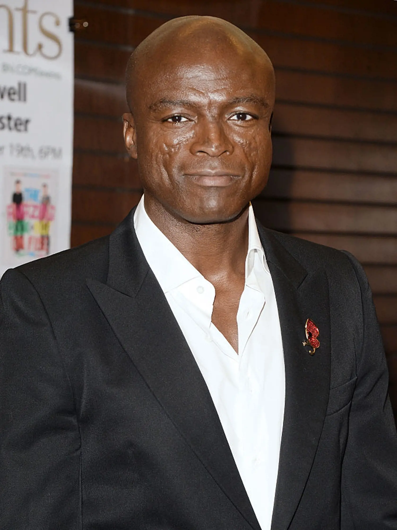 Seal má nigérijsko-brazílsky pôvod. Na tvári má charakteristické jazvy. Tie spôsobila autoimunitná choroba lupus erythematosus, ktorá ho postihla v detstve. 