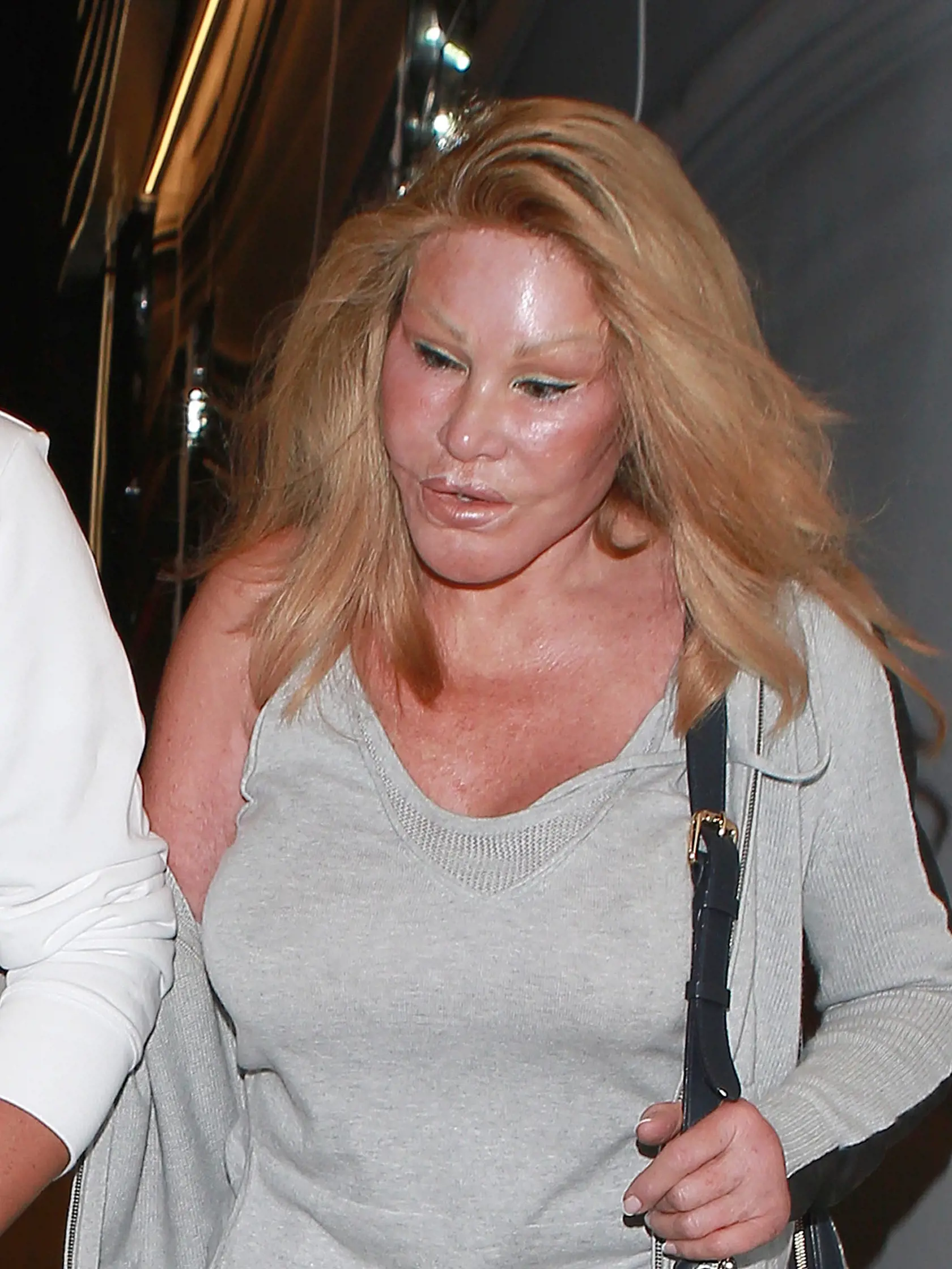 Jocelyn Wildenstein 