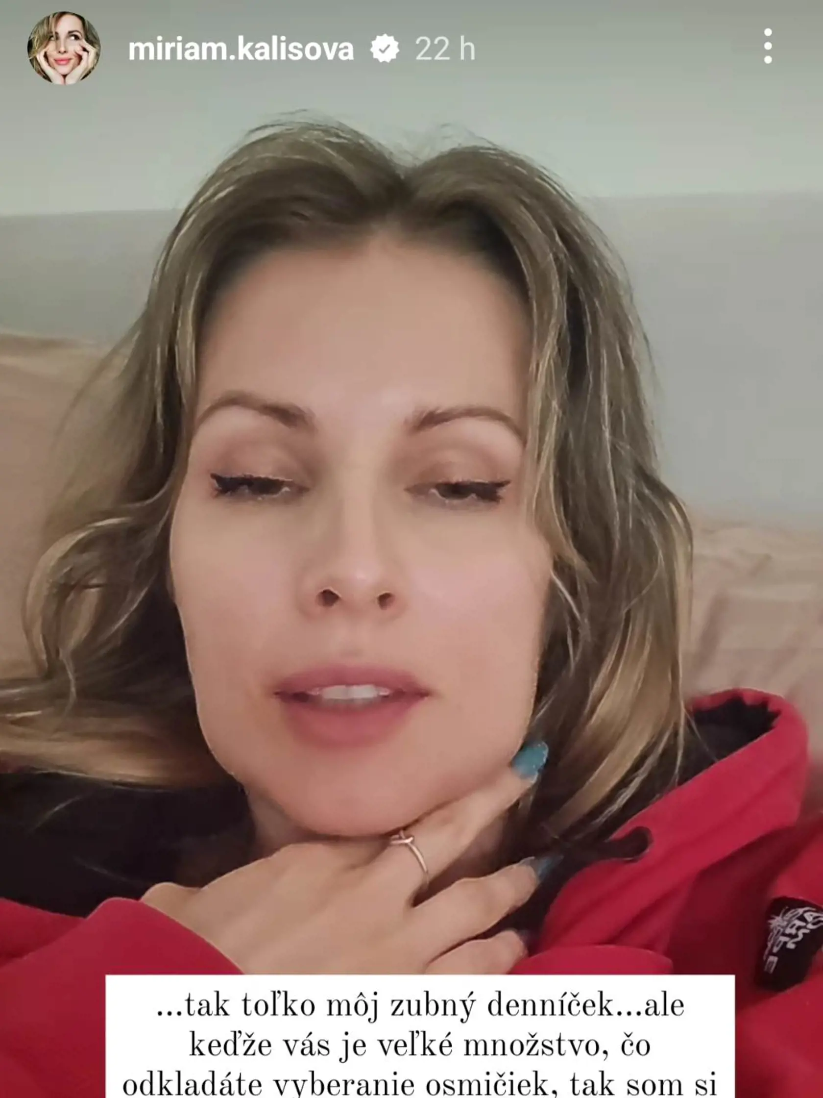 Takto vyzerala Miriam po zákroku.