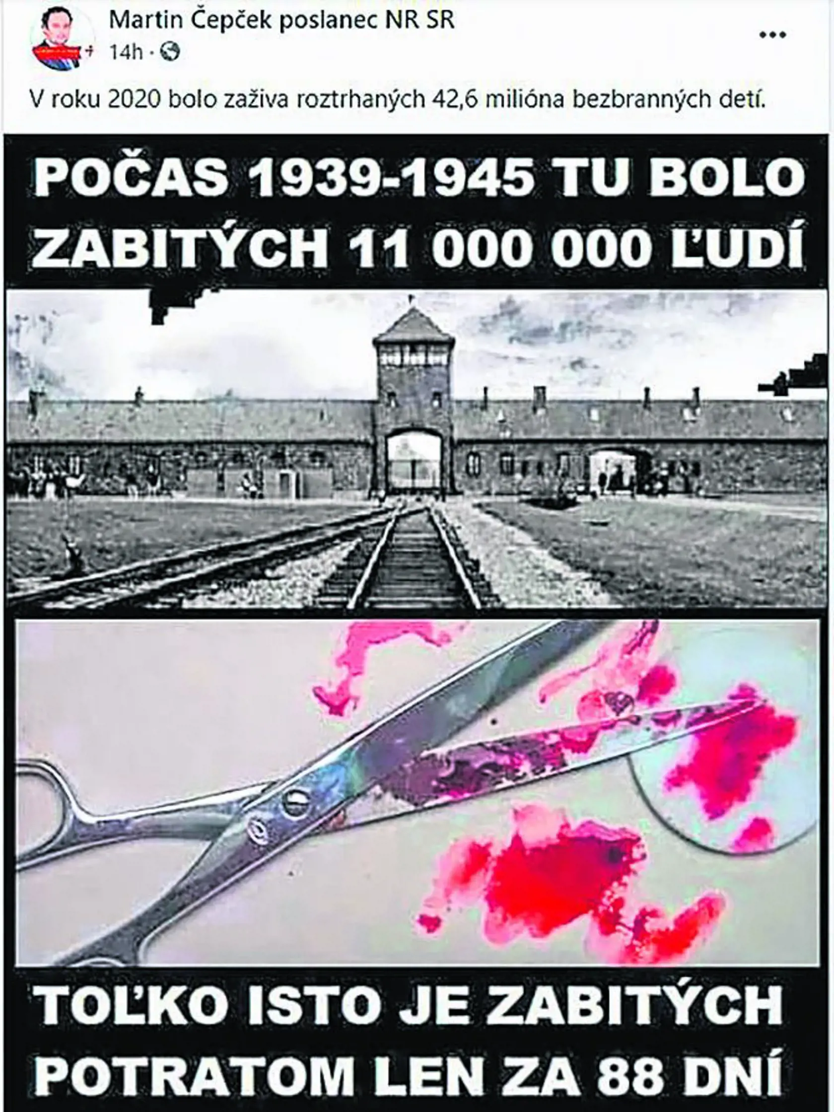Poslanec Čepček už tretíkrát skúsi v parlamente presadiť sprísnenie interrupcií. Neštíti sa pritom potraty prirovnávať k obetiam holokaustu.