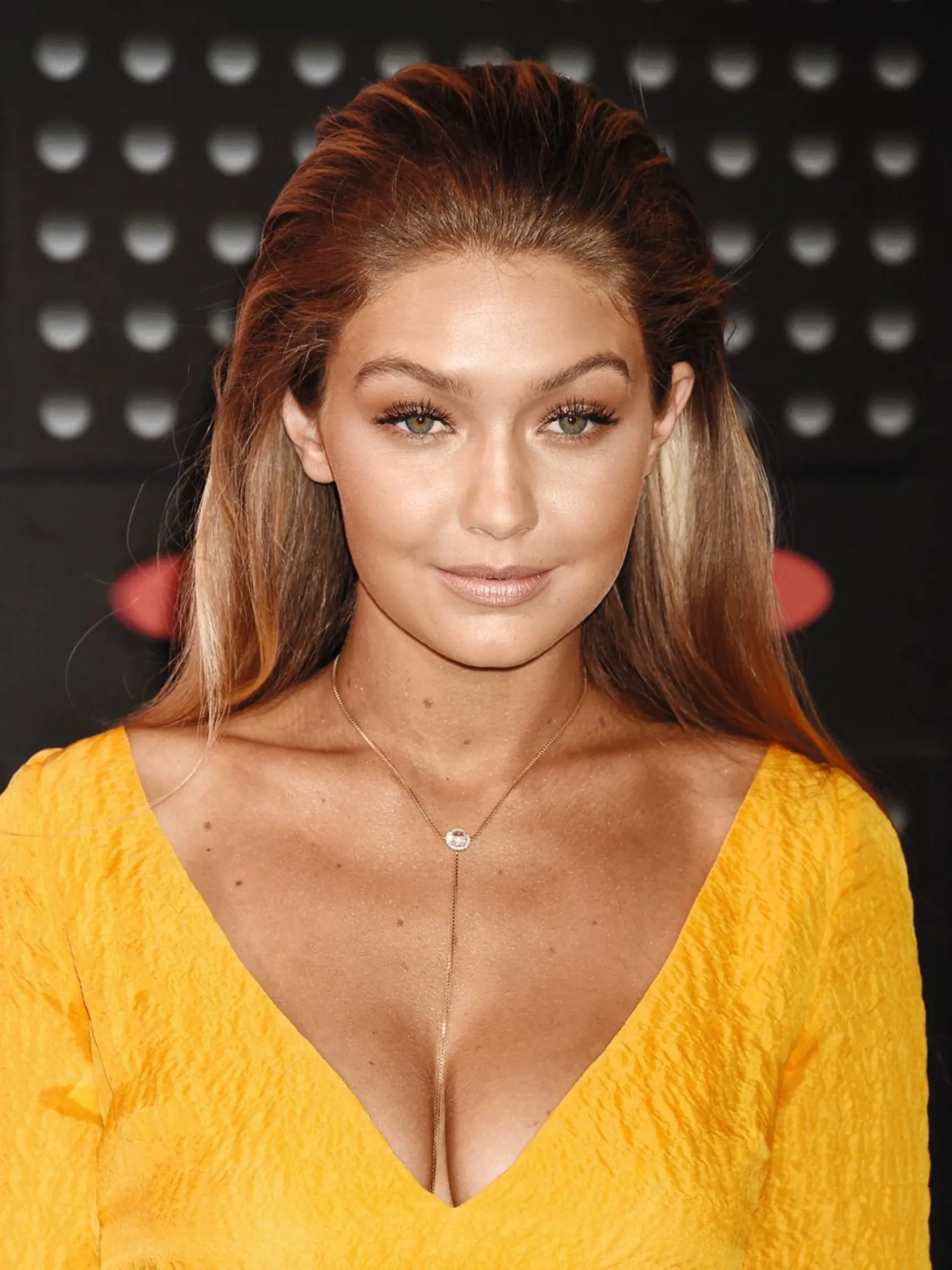IT girls, speváčky, herečky či influencerky sú posadnuté túžbou po dokonalej tvári, a tak využívajú všetky dostupné možnosti estetickej medicíny. A na sociálnych sieťach sa tým rady pochvália.