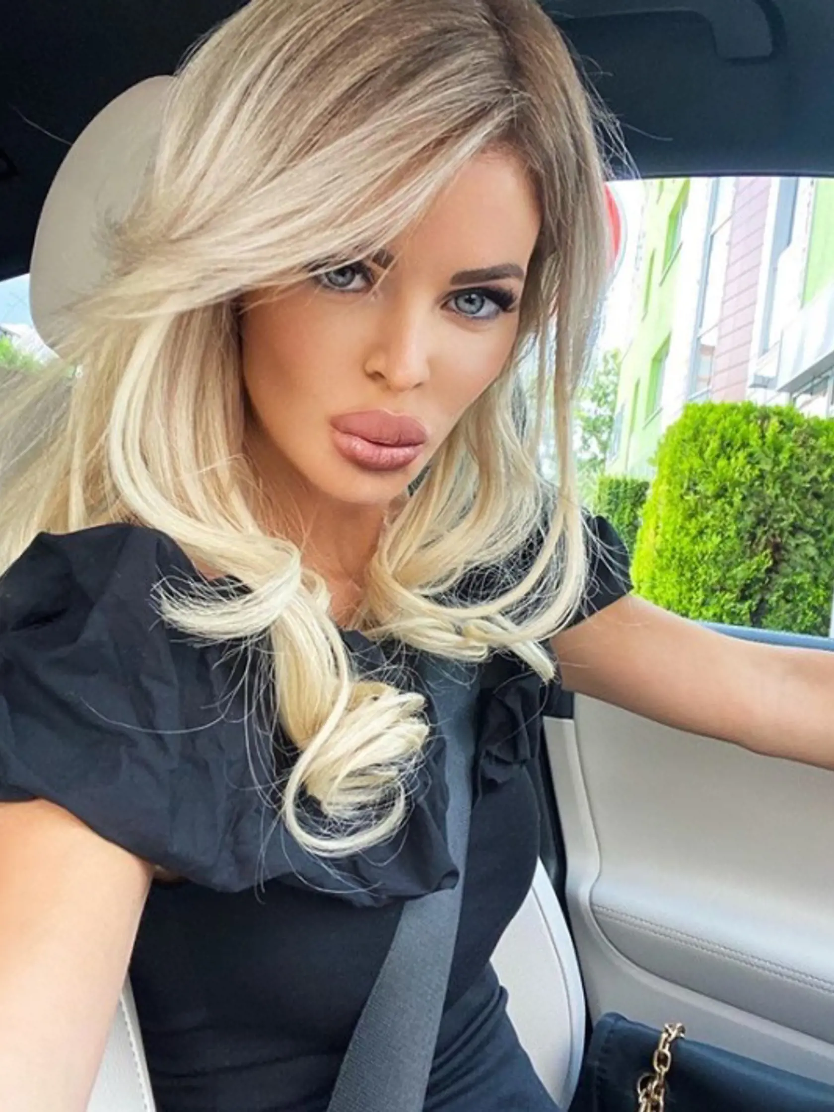 Silvia Kucherenko: Najskôr zmenila farbu vlasov z platinovej na špinavú blond. Potom si dala zmenšiť kačacie pery. Takto vyzerá návrat k akej-takej prirodzenosti plastikovej modelky barbie.