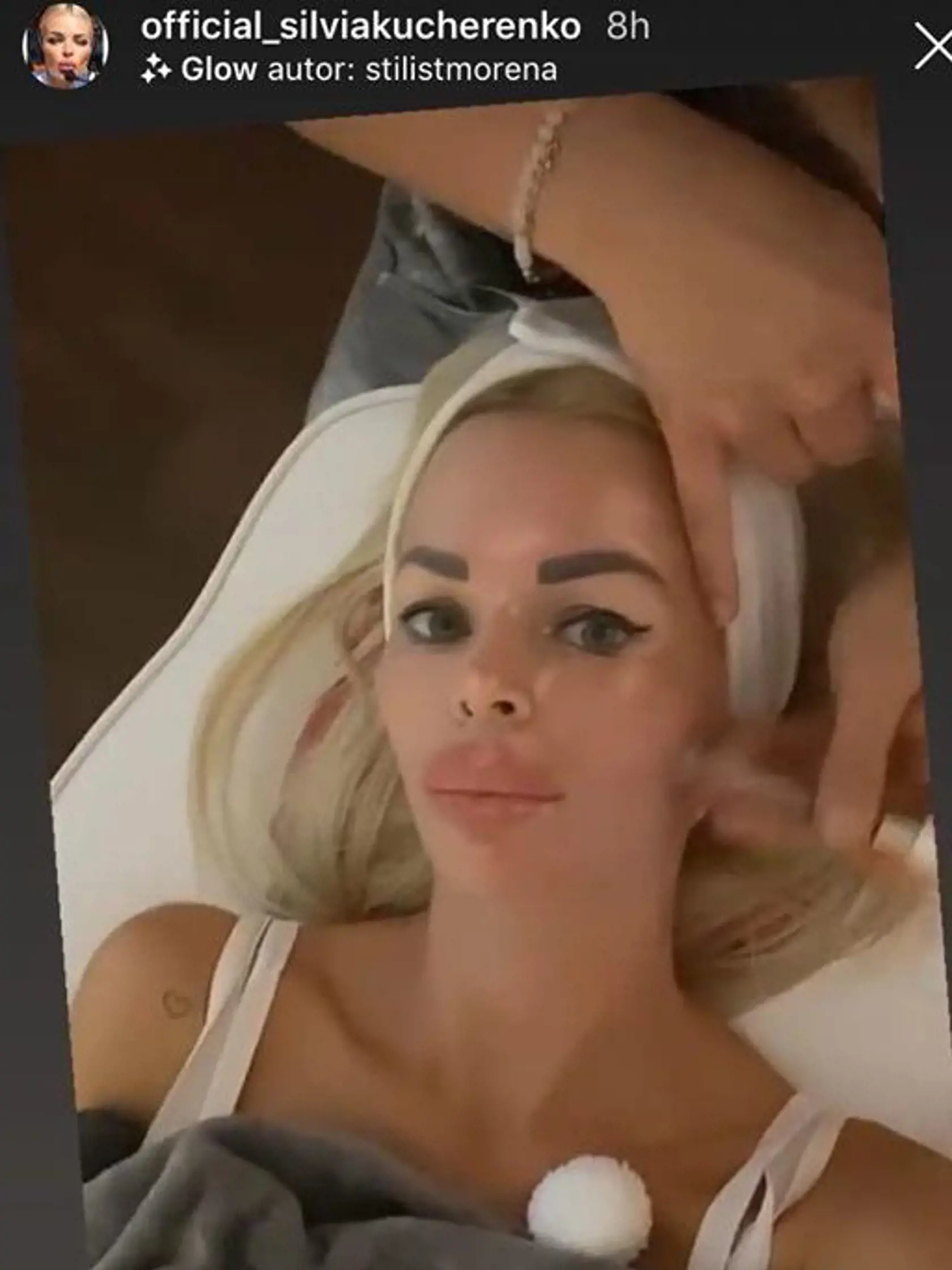 Silvia Kucherenko má opäť väčšie pery.