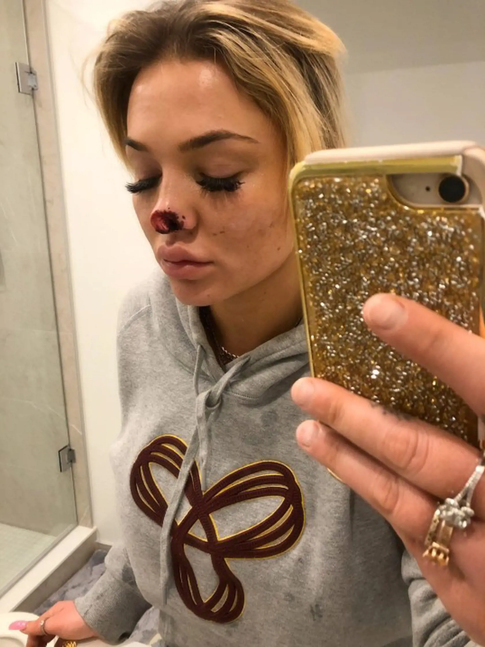 Allyson Danylko (24)