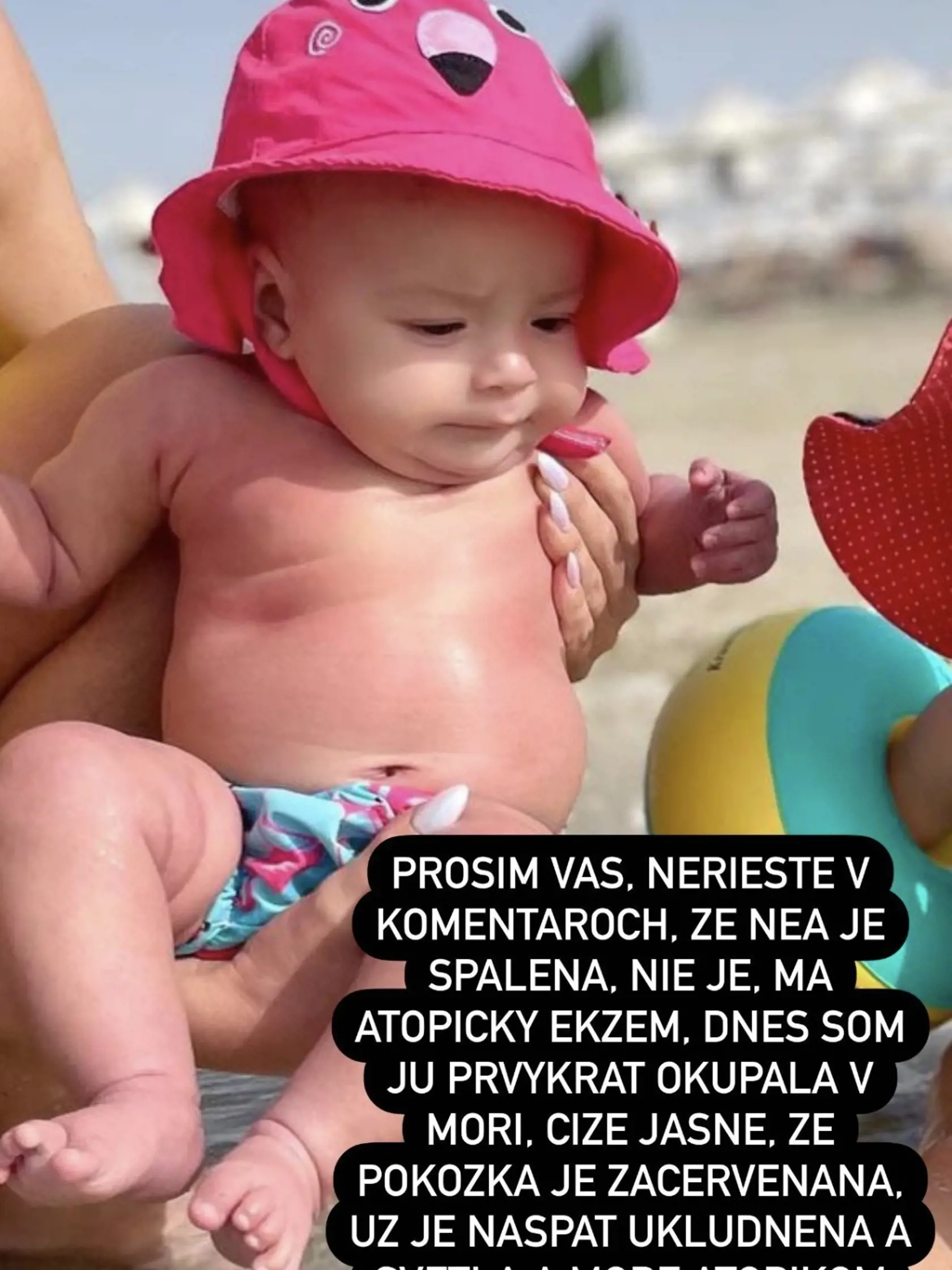 Nea má kožné problémy.