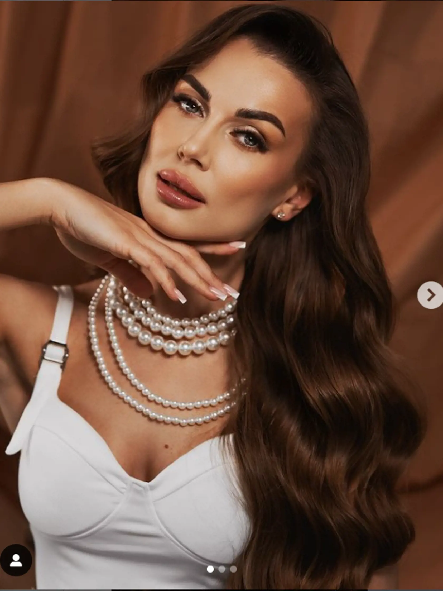 Stanka tvrdí, že nemá žiadne plastiky. Priznala iba pichnuté pery.