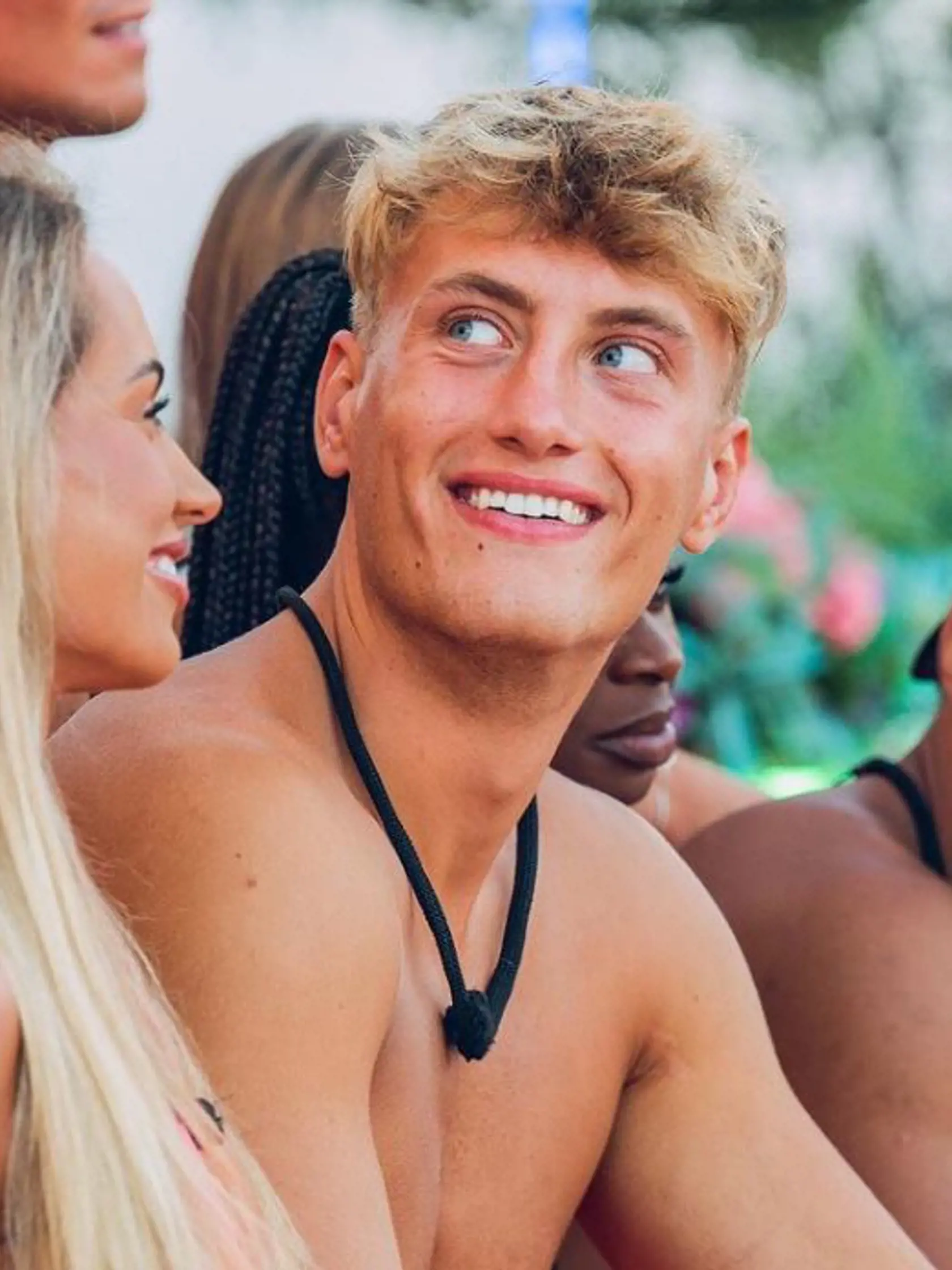 David z Love Island nebol spokojný so svojím krivým nosom.